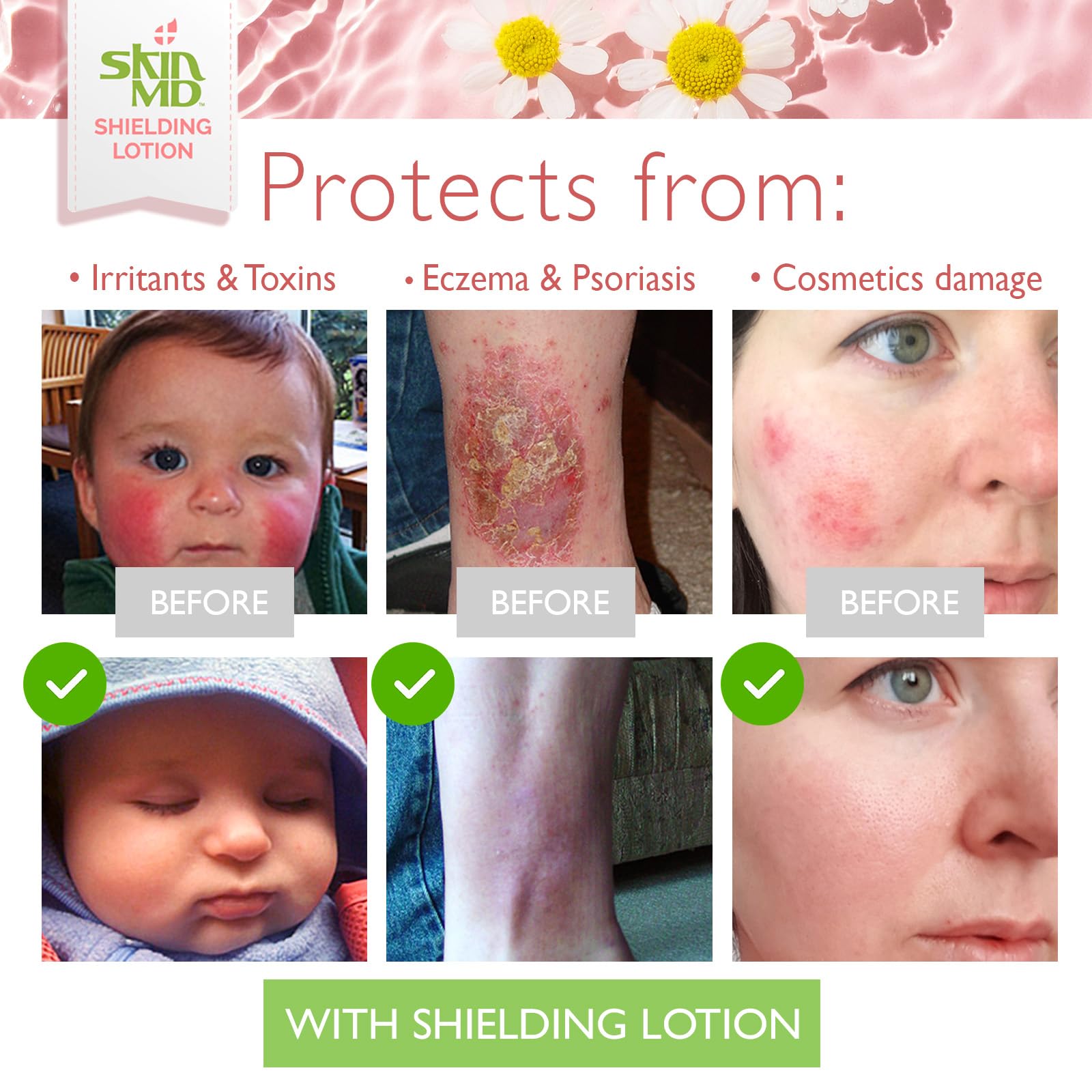 Skin MD Shielding Lotion – Fragrance-Free, Hypoallergenic Moisturizer for Face, Body & Hands | 8oz