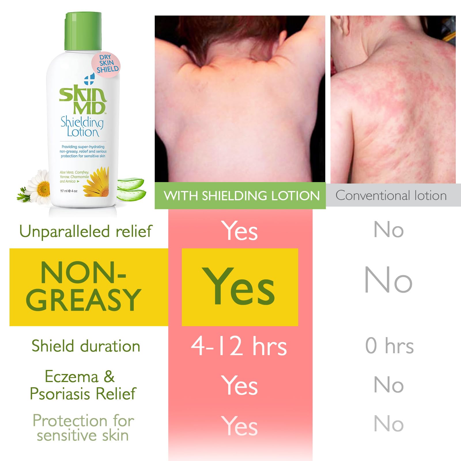 Skin MD Shielding for Face & Body | Hypoallergenic Moisturizer (8 oz)
