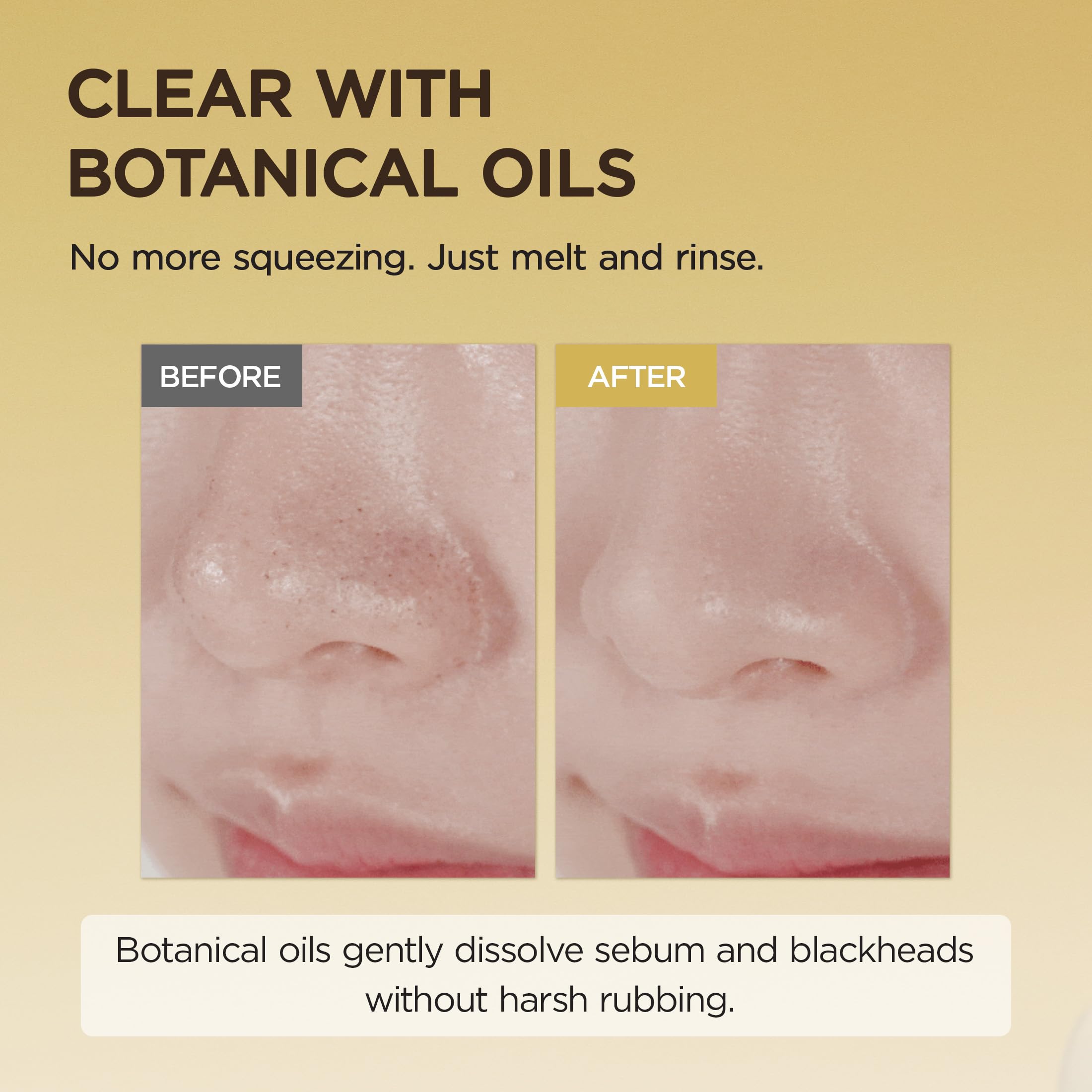 SKIN1004 Madagascar Centella Light Cleansing Oil 200ml – Gentle Face Cleanser