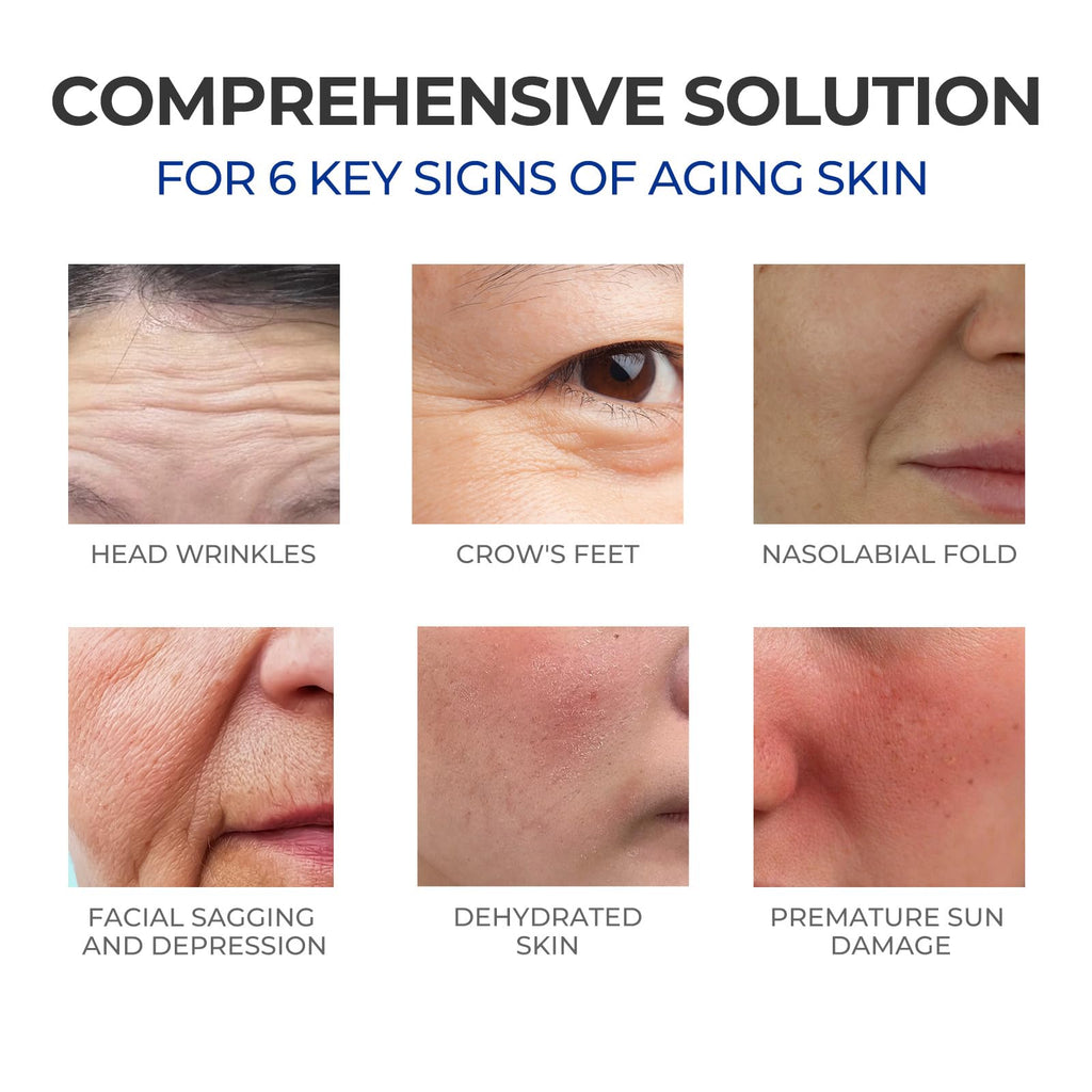 SKINERSE Retinol Serum for Face – Anti-Aging, Vitamin E, Pore Minimizer, 1 oz