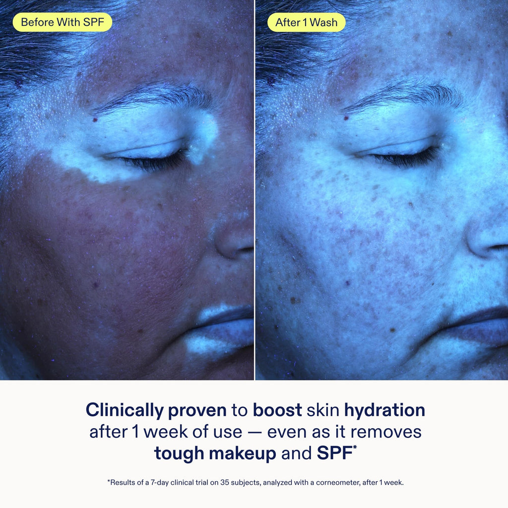 Skinfix Ceramide + Ectoin Gentle Gel Cleanser – 5 oz | Removes Makeup & SPF | Vegan & Cruelty-Free