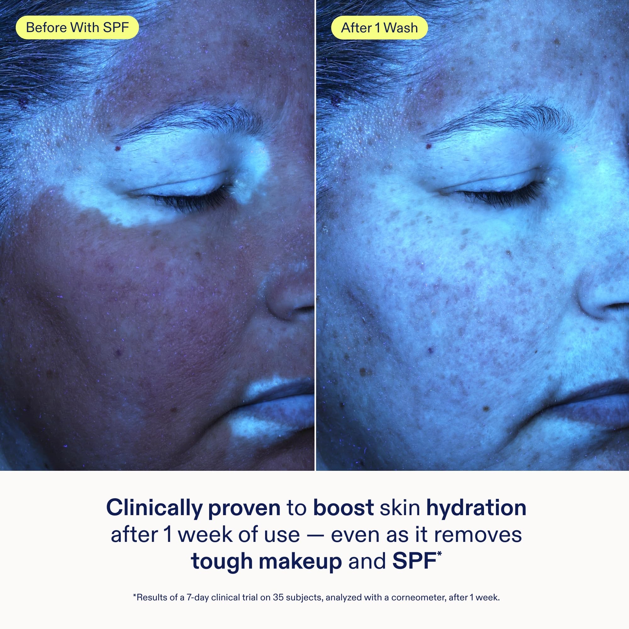 Skinfix Ceramide + Ectoin Gentle Gel Cleanser – 5 oz | Removes Makeup & SPF | Vegan & Cruelty-Free