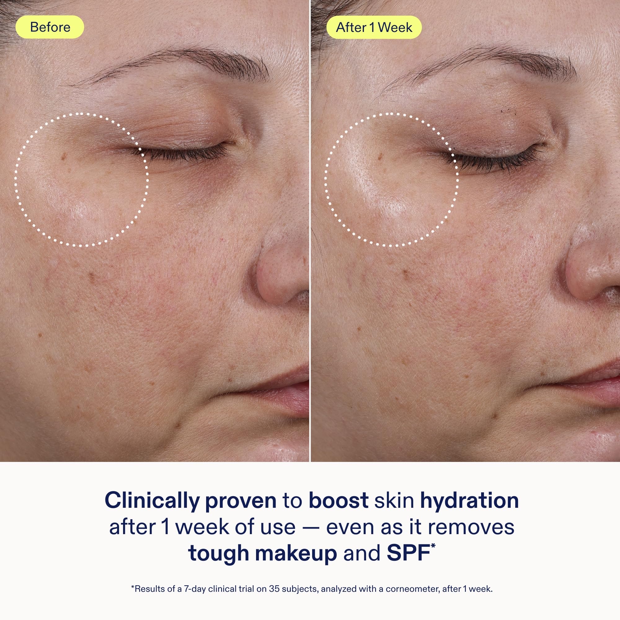 Skinfix Ceramide + Ectoin Gentle Gel Cleanser – 5 oz | Removes Makeup & SPF | Vegan & Cruelty-Free