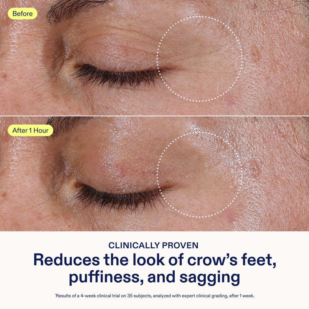 Skinfix Triple Lipid Eye Treatment - 0.5 oz, Fragrance-Free, Vegan Eye Cream