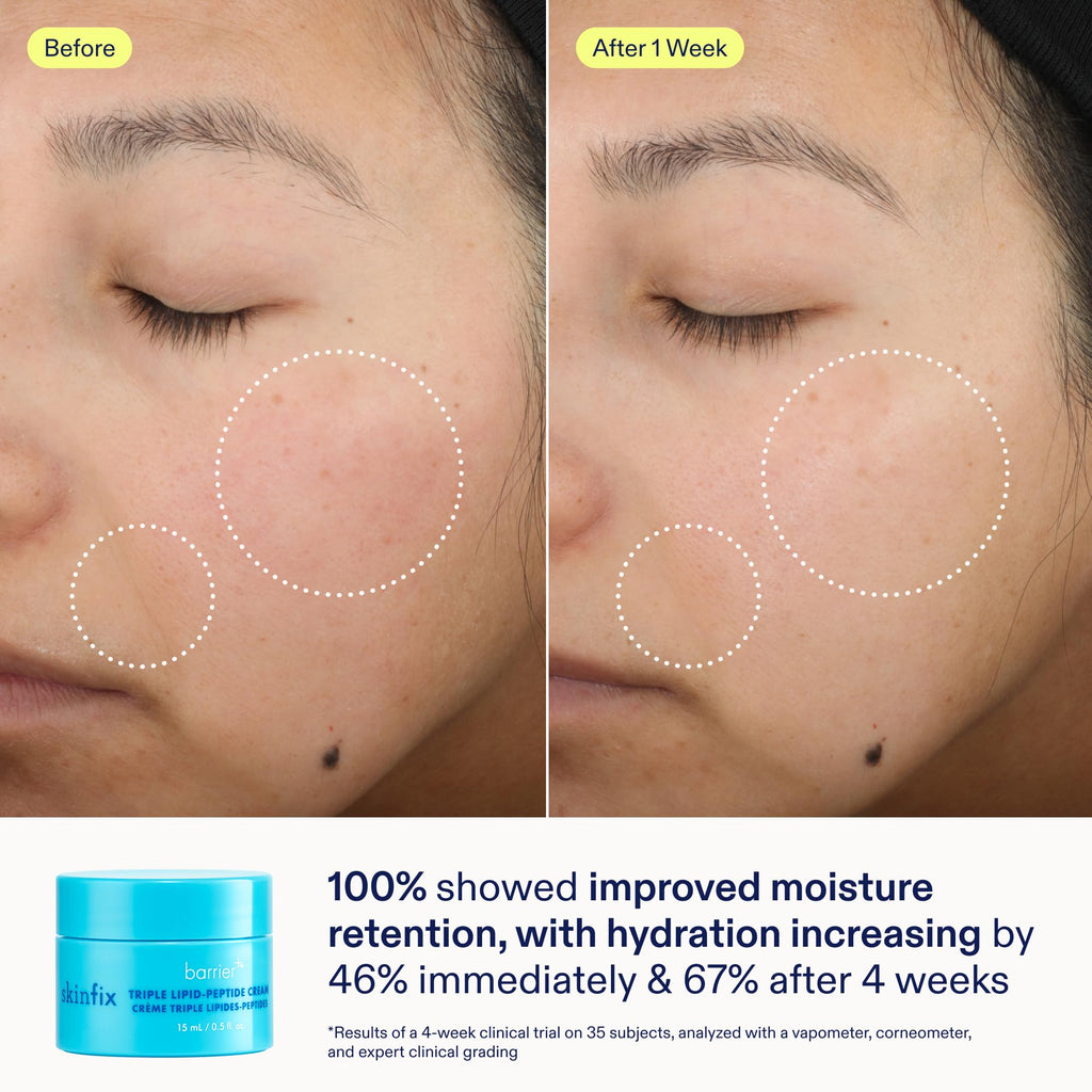 Skinfix Barrier+ Kit – Mini Cream, Cleanser & Serum | Vegan & Cruelty-Free