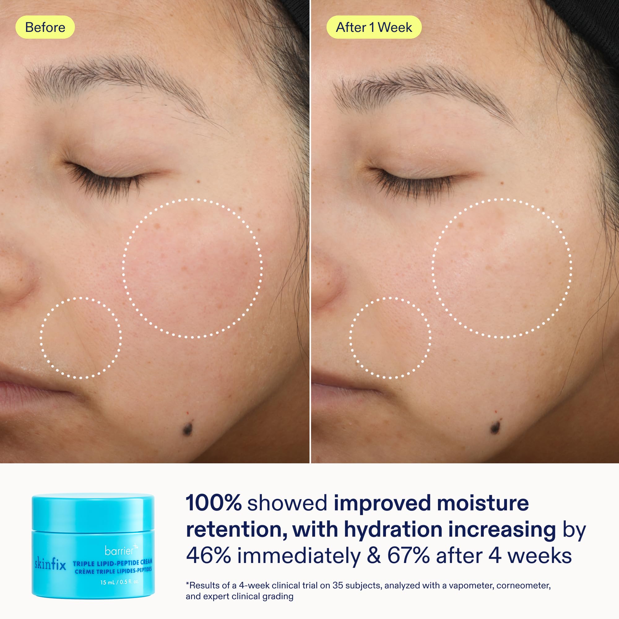 Skinfix Barrier+ Kit – Mini Cream, Cleanser & Serum | Vegan & Cruelty-Free