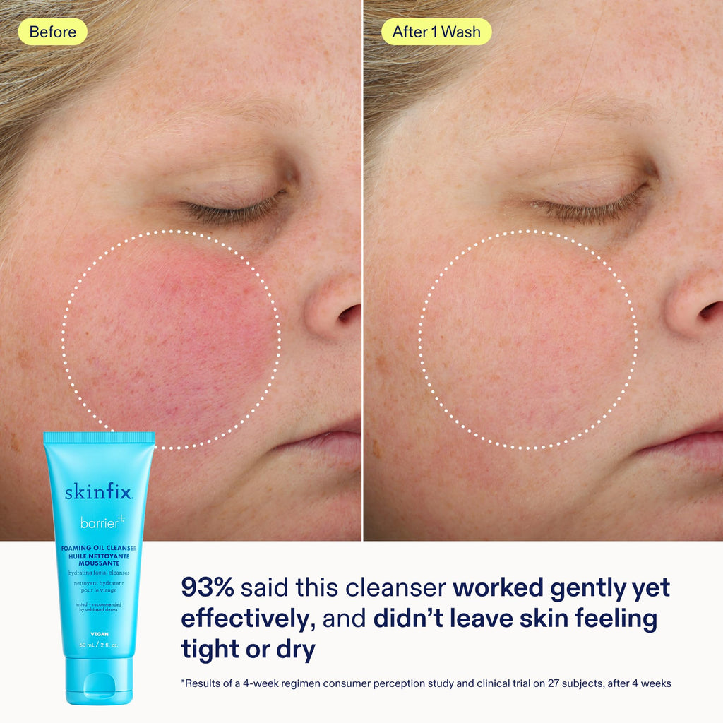 Skinfix Barrier+ Kit – Mini Cream, Cleanser & Serum | Vegan & Cruelty-Free