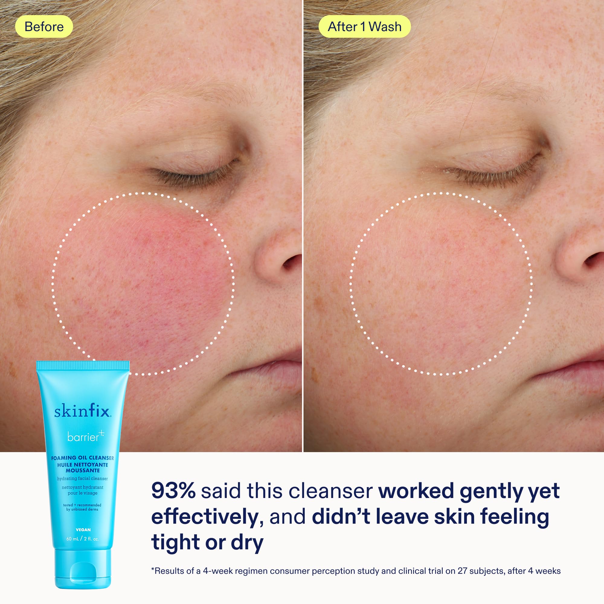 Skinfix Barrier+ Kit – Mini Cream, Cleanser & Serum | Vegan & Cruelty-Free