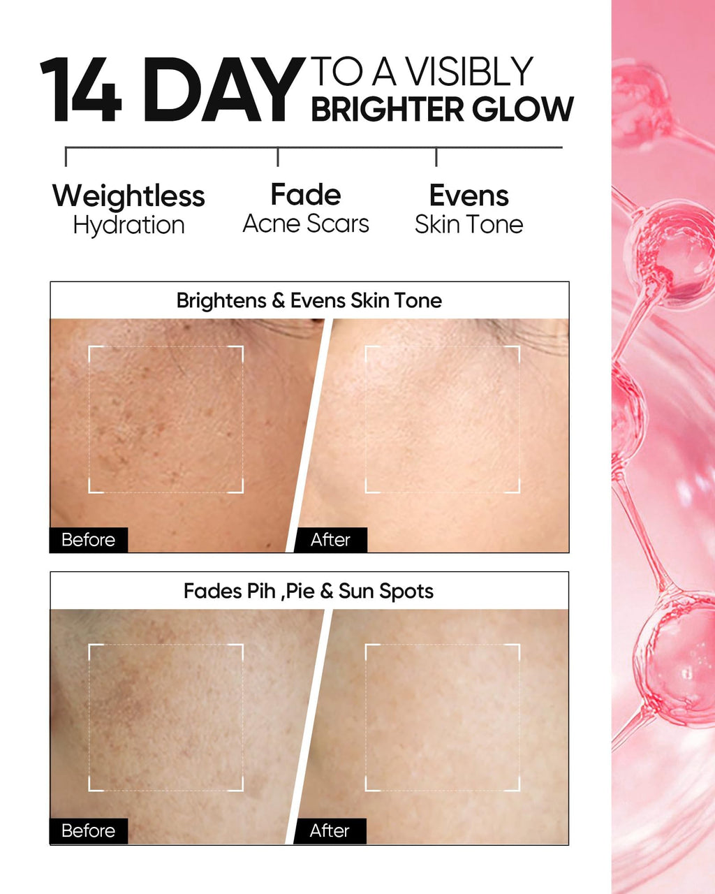 SKINTIFIC MSH Niacinamide Brightening Cream – Even Tone, Dark Spot Fading (100g) with Tranexamic Acid & α-Arbutin