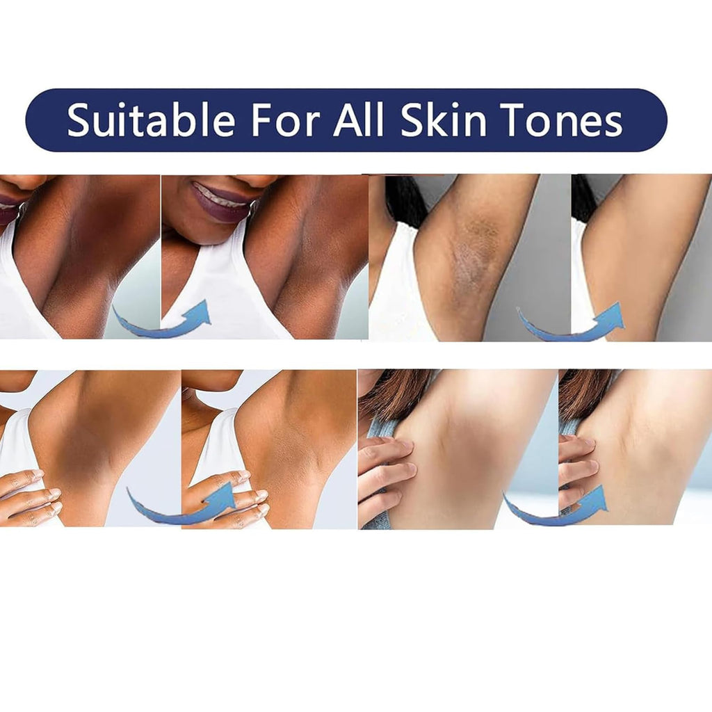 SMILEFACE Intimate Areas Skin Lightening Cream for Private Parts, Underarms & More | Gentle, All-Skin-Tone Safe