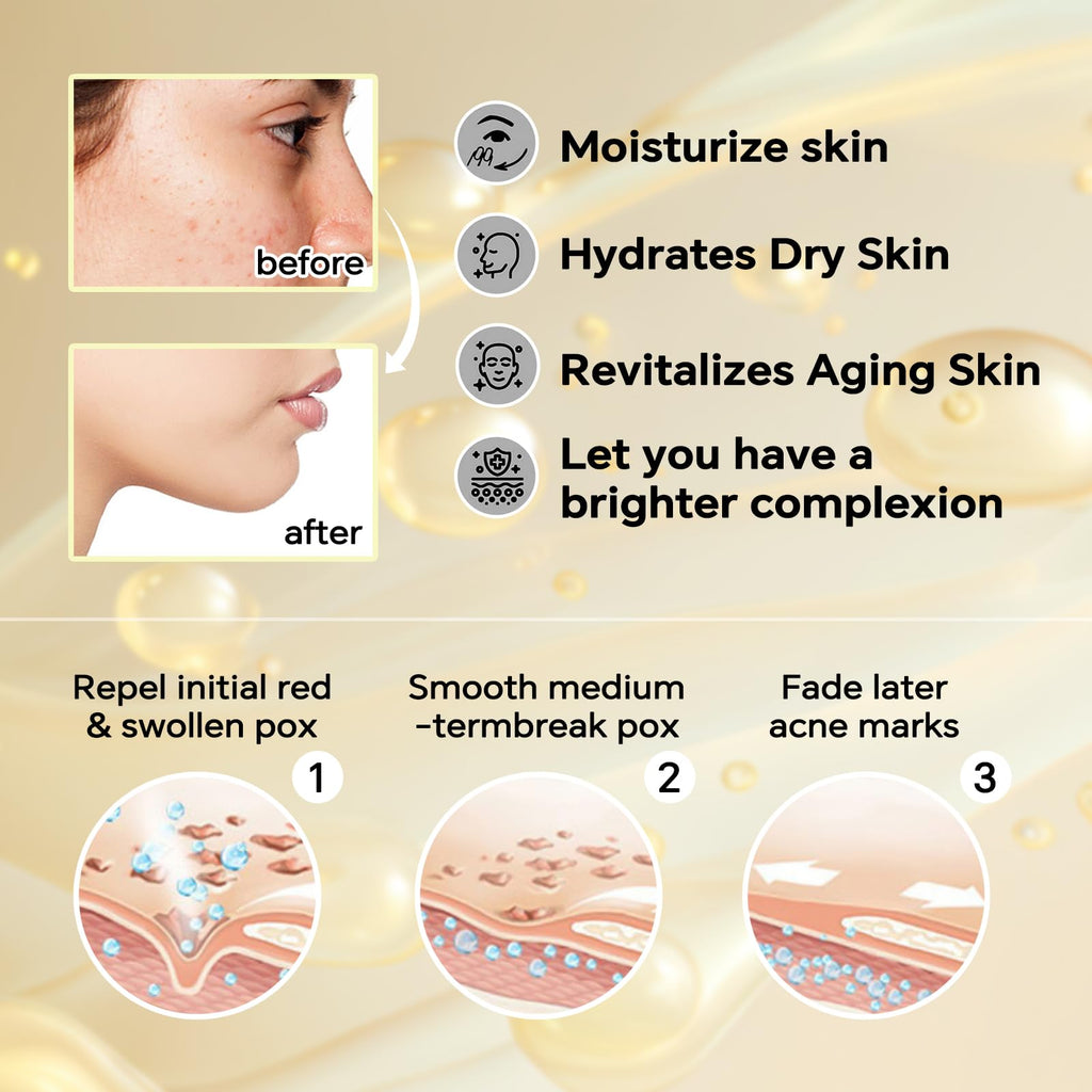 Sokgo Snail Mucin Cream | Revitalizing Hydrating Moisturizer for All Skin Types
