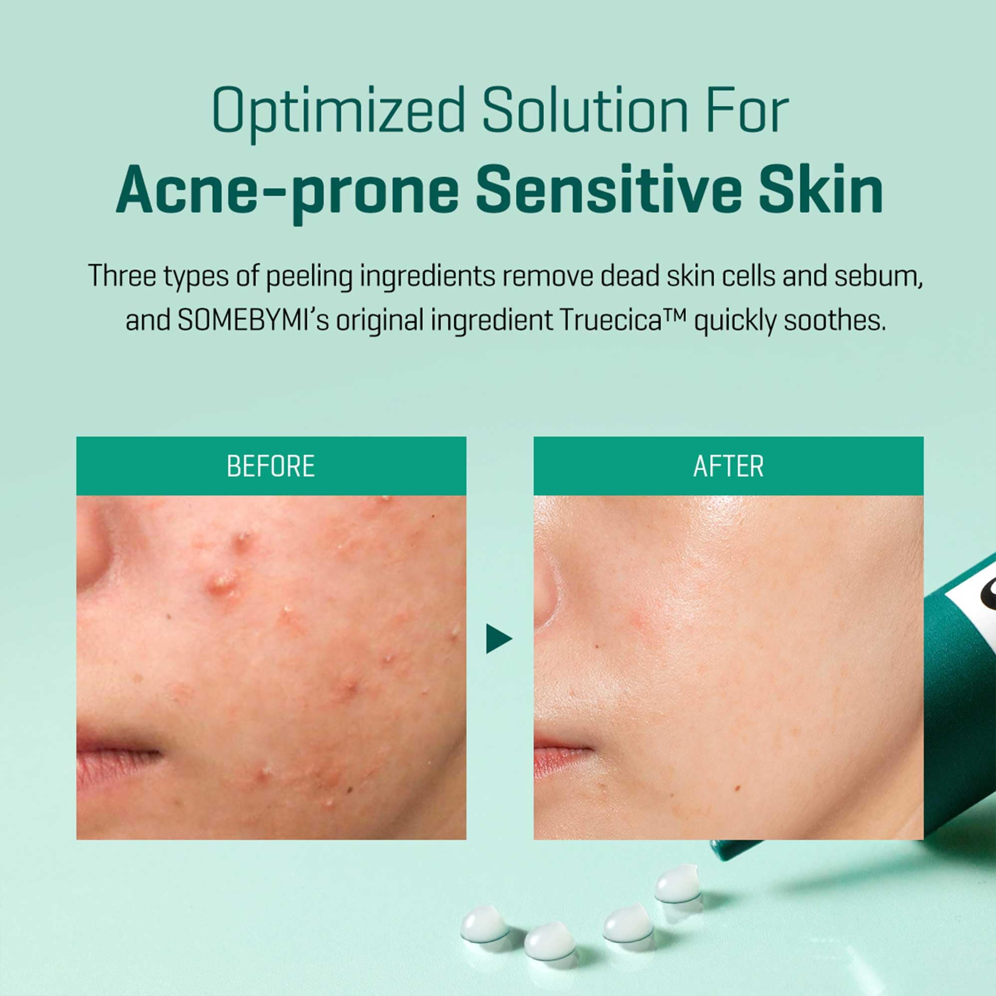 SOME BY MI AHA BHA PHA 14 Days Miracle Spot Cream – 1.01oz, 30ml with Hyaluronic Acid & Centella