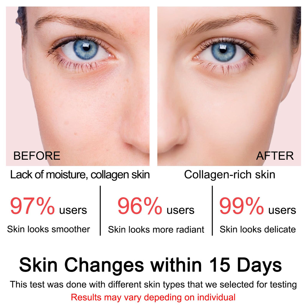 SOYUB Collagen Jelly Cream – Niacinamide, Hydration & Elasticity for All Skin Types