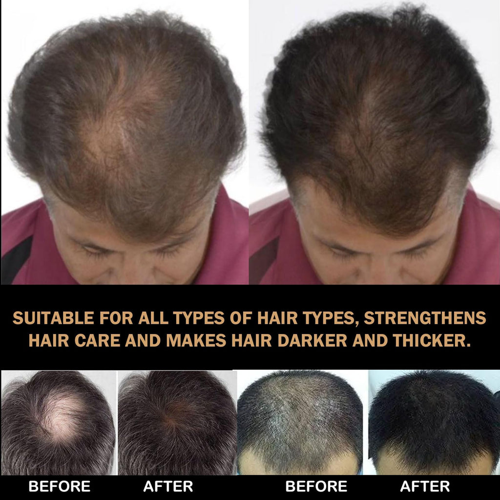 SPARTAN REPAIR SHAMPOO Root Activator - 200ml for Hair Growth & Thickness