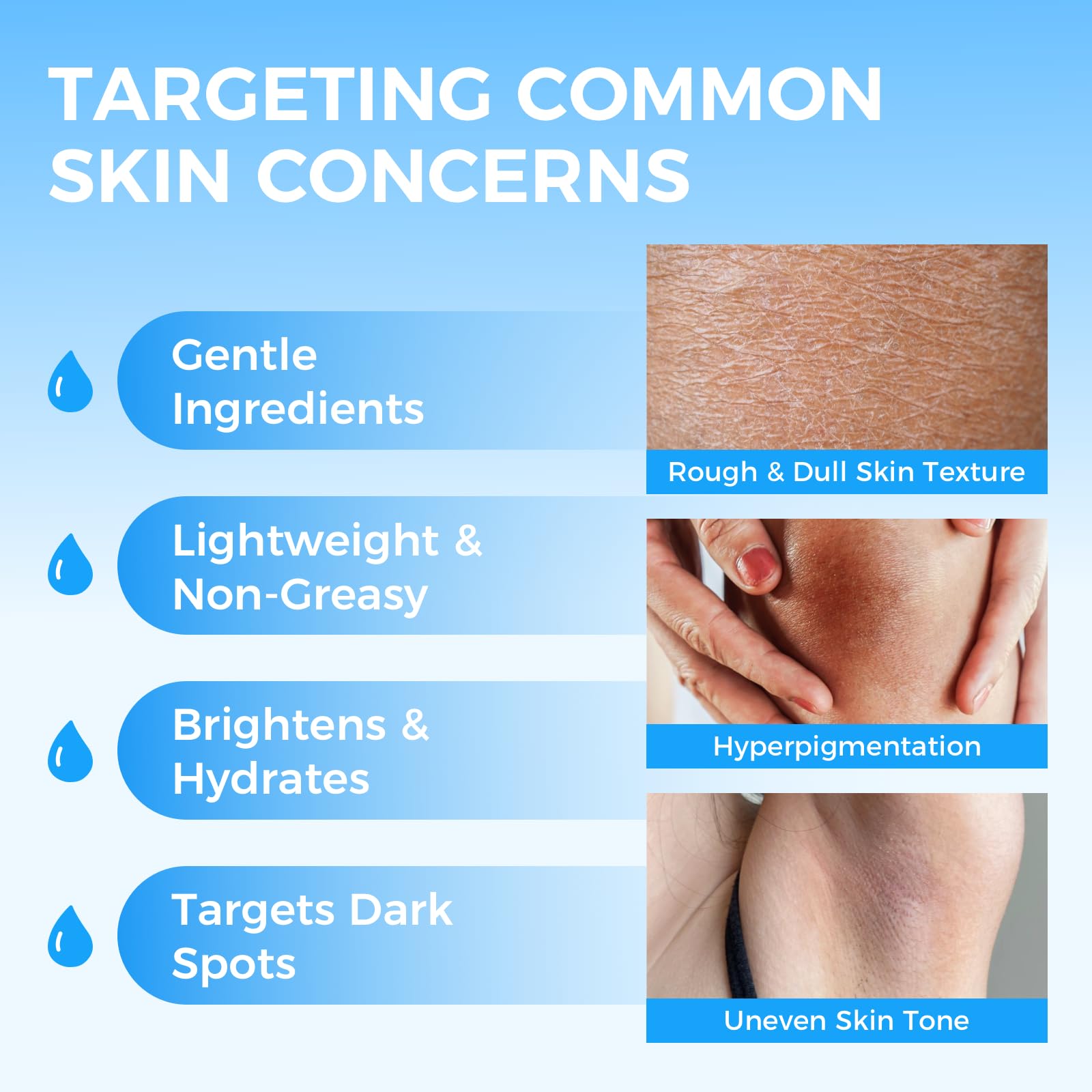 Sperandi Moisturizing Dark Spot Remover for Body with Vitamin C – Gentle Lightening Cream for Underarms, Bikini Line & More (1.7 fl oz)
