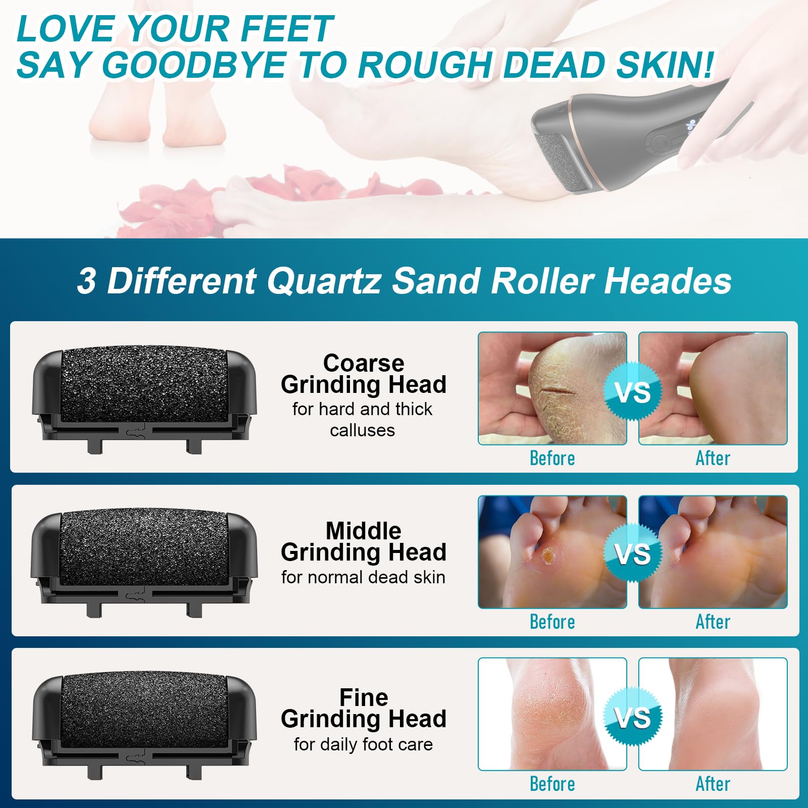 Spriak 16-in-1 Electric Callus Remover Kit – Rechargeable Foot Care Tool for Home Pedicure