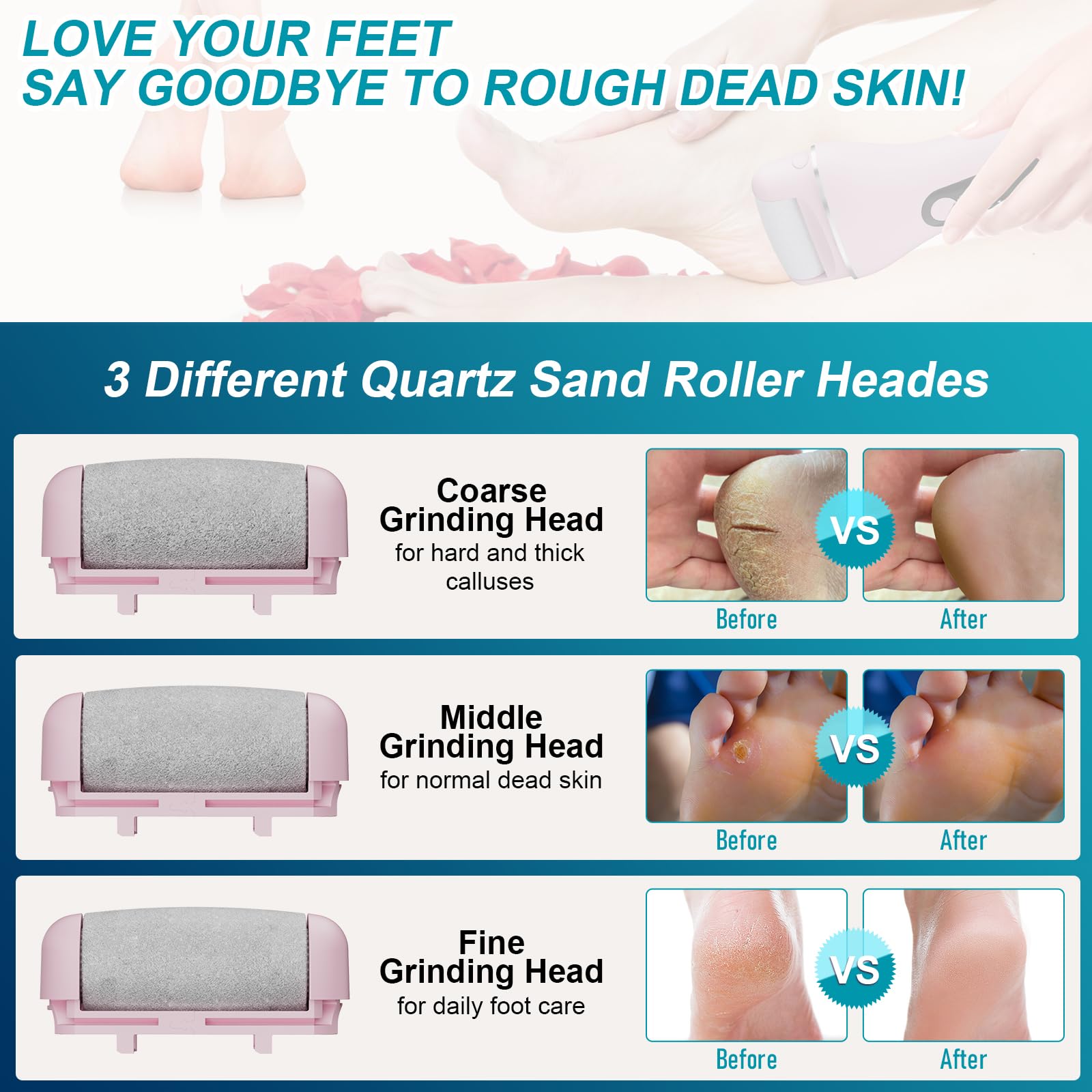 Spriaq 16-in-1 Electric Callus Remover for Feet – Rechargeable Pink Kit