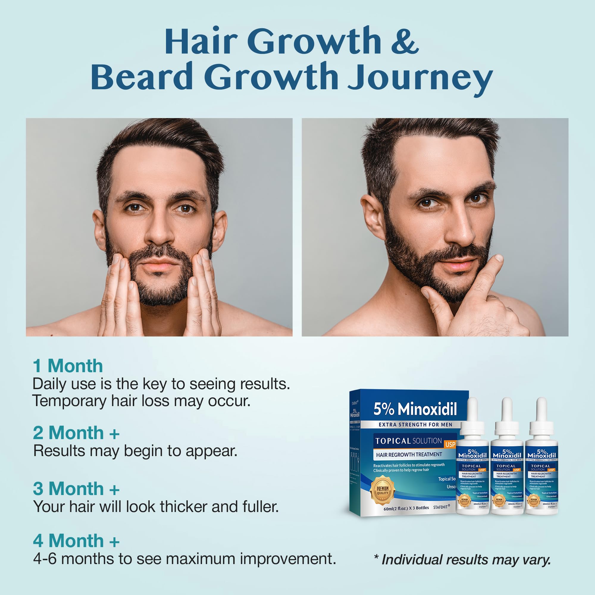 Stafenit 5% Minoxidil Hair Growth Serum for Men and Women — Extra Strength Beard & Scalp Regrowth, 3 x 60ml