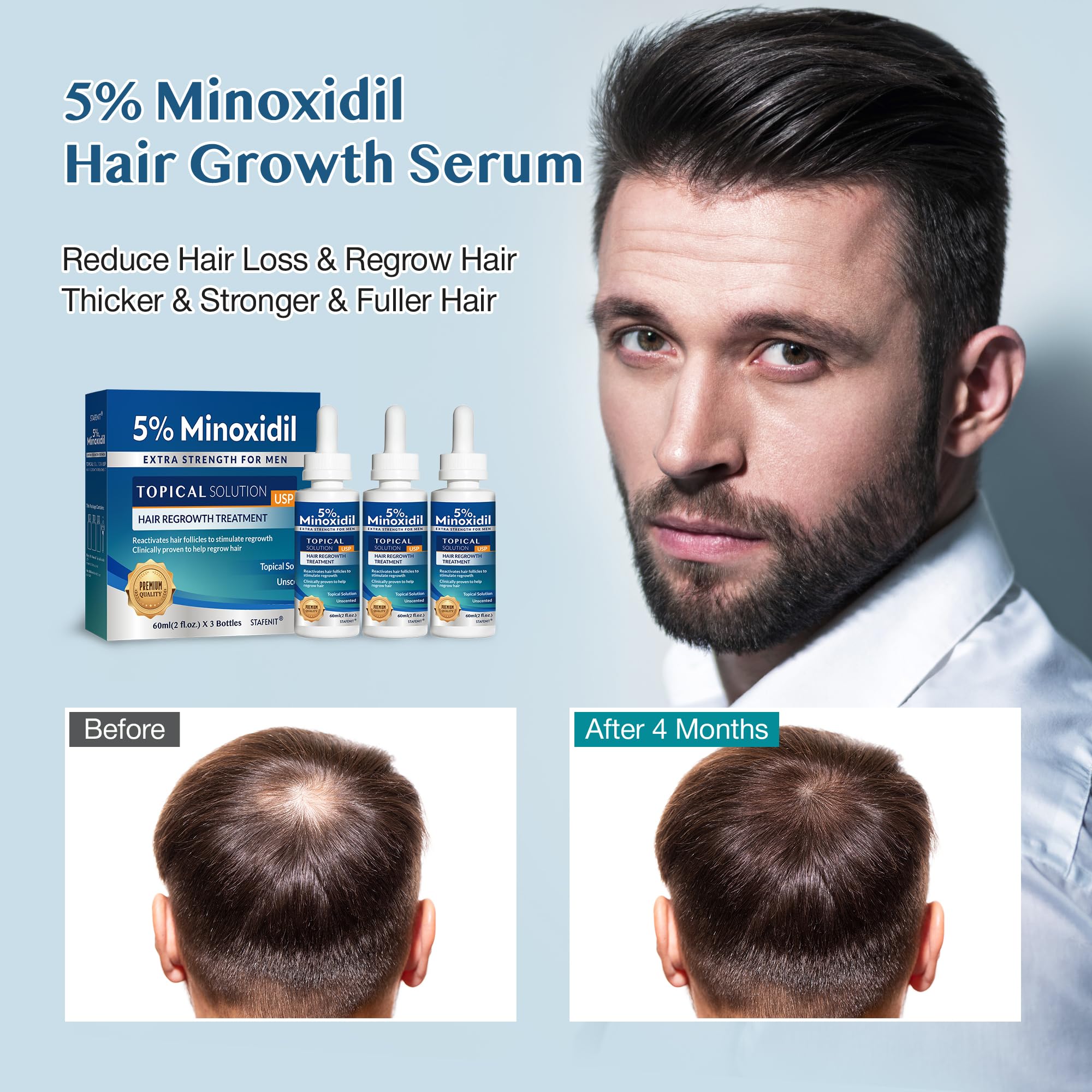 Stafenit 5% Minoxidil Hair Growth Serum for Men and Women — Extra Strength Beard & Scalp Regrowth, 3 x 60ml