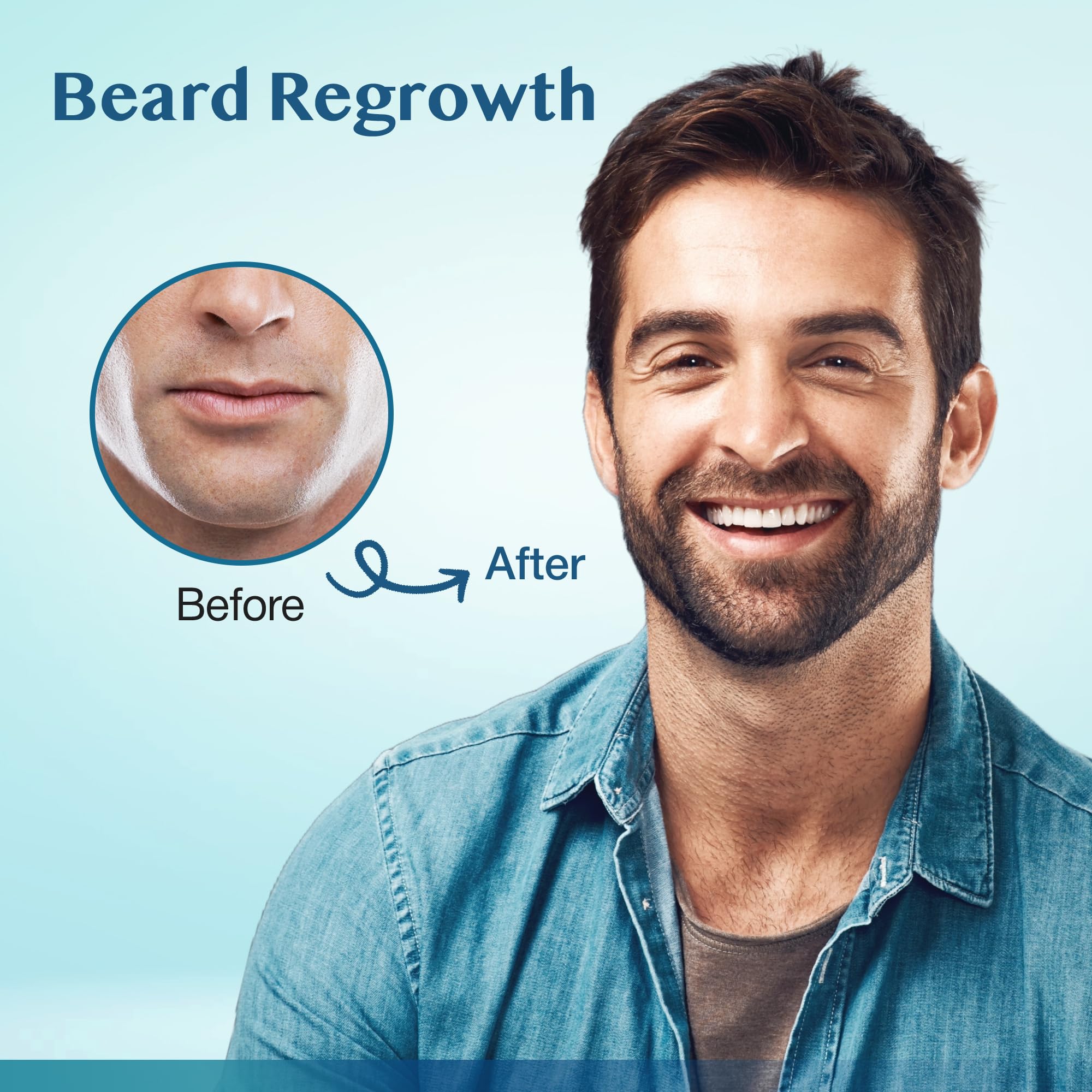 Stafenit 5% Minoxidil Hair Growth Serum for Men and Women — Extra Strength Beard & Scalp Regrowth, 3 x 60ml