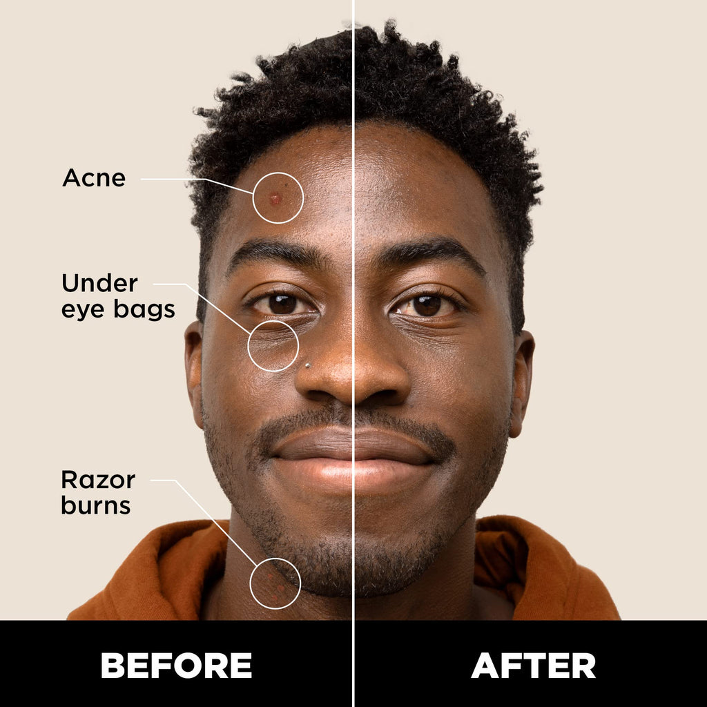 Stryx Concealer Stick Tool for Men – Deep Java, Undetectable Coverage