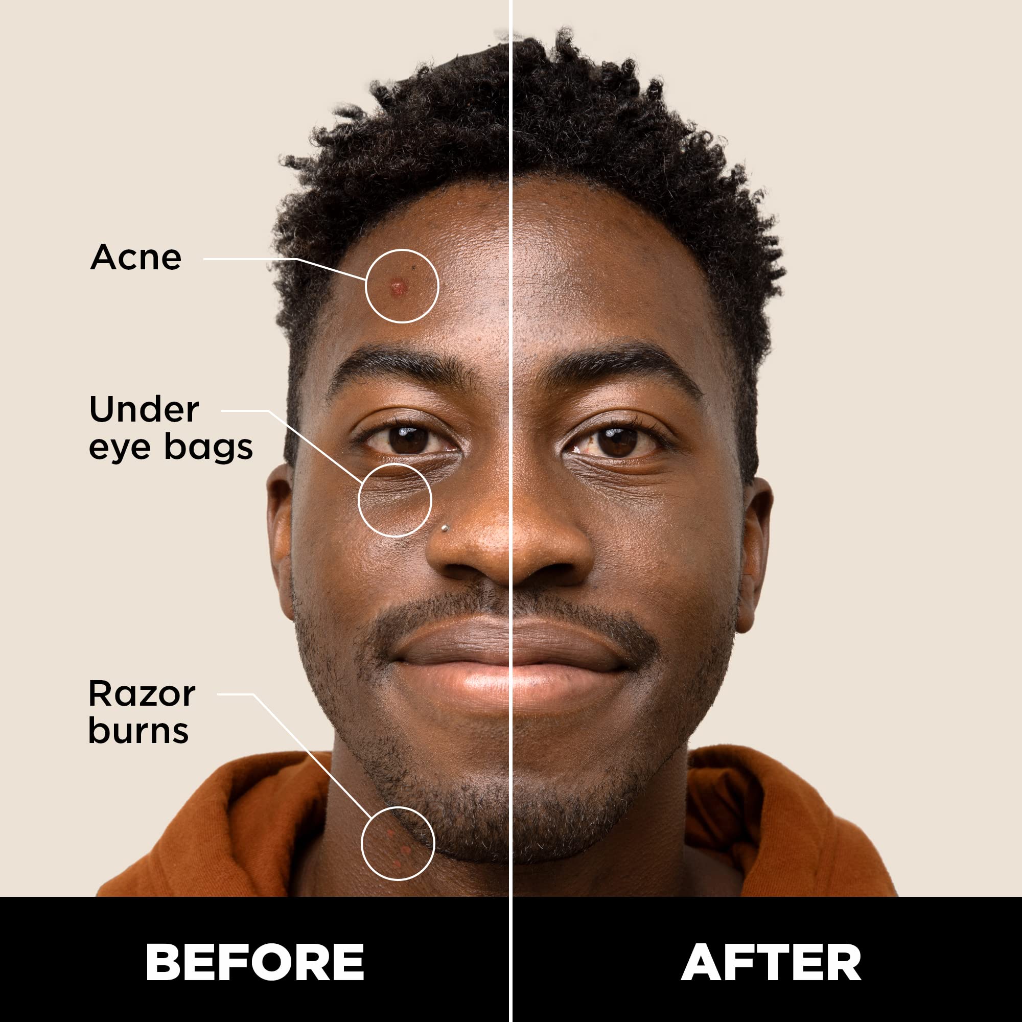 Stryx Concealer Stick Tool for Men – Deep Java, Undetectable Coverage