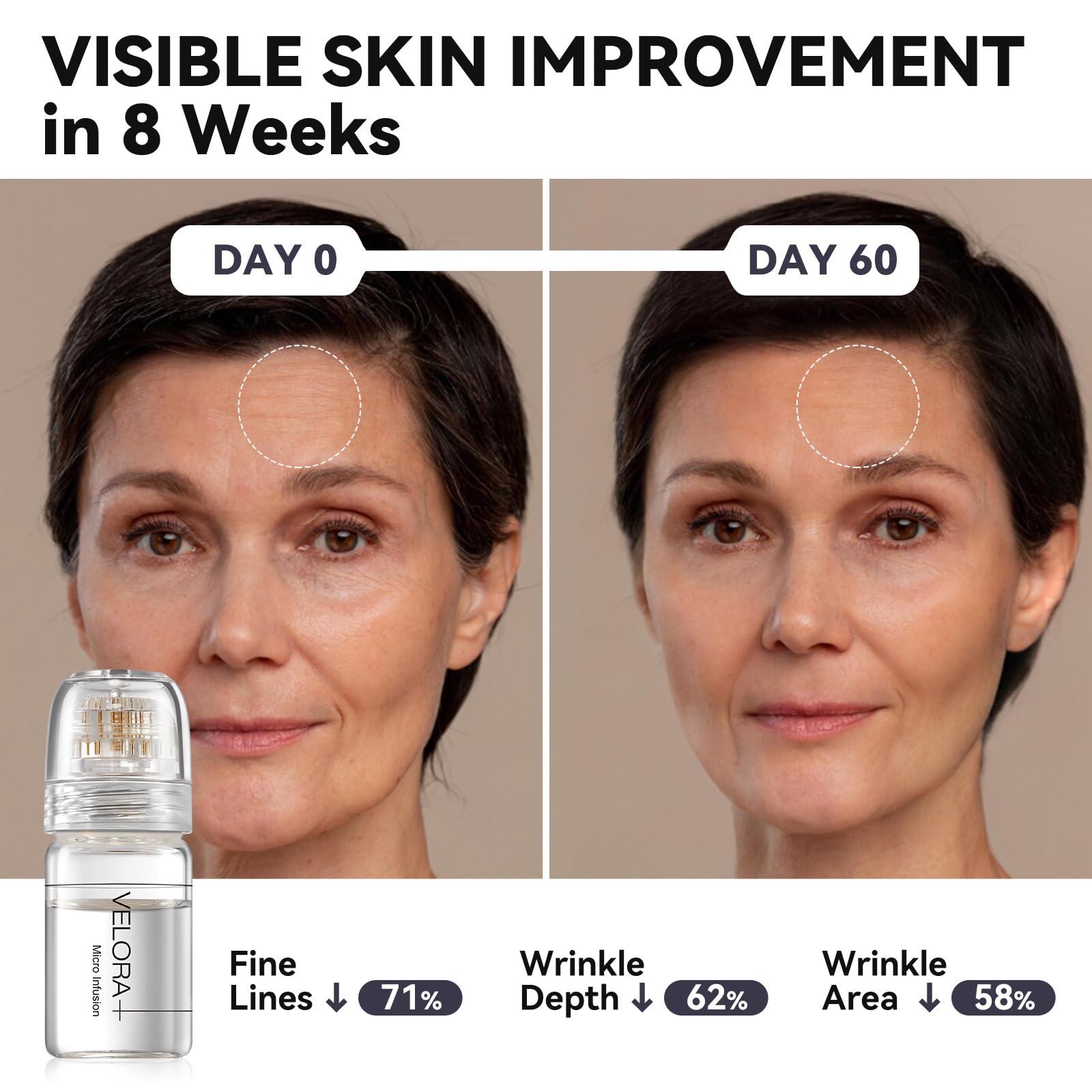 Styirl Micro Infusion System for Face – Hydrating Serum with Hyaluronic Acid & Peptides, 0.25mm Stamp (3-Month Supply)