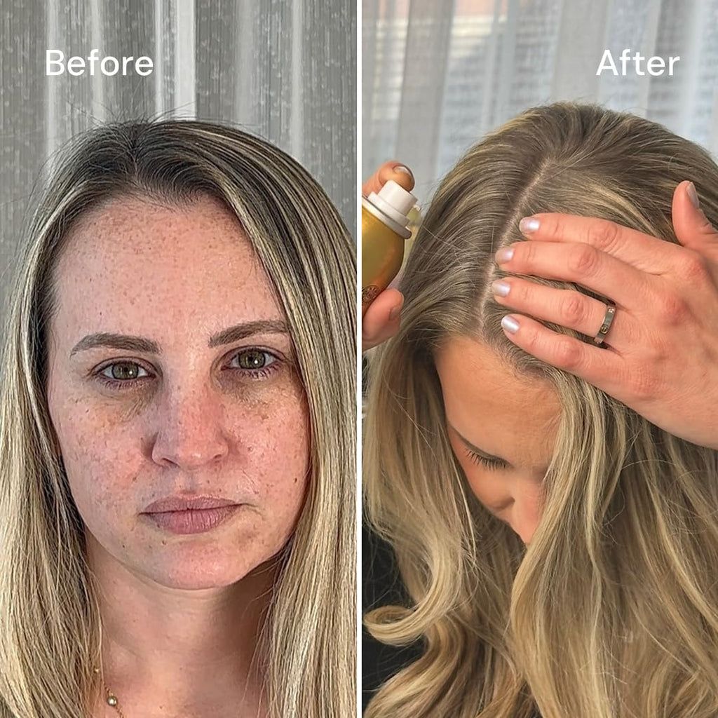 STYLE EDIT DARK BLONDE Root Concealer Spray – Instant Root Coverage (4 oz, Pack of 5)