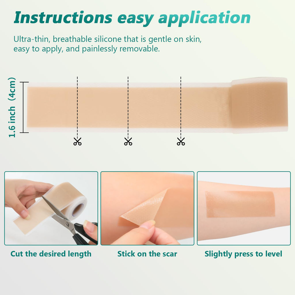 SUCONBE Silicone Scar Tape – Medical Grade Scar Sheets (1.6 x 160 in Roll) for C-Section, Tummy Tuck, and Post-Surgery Scars