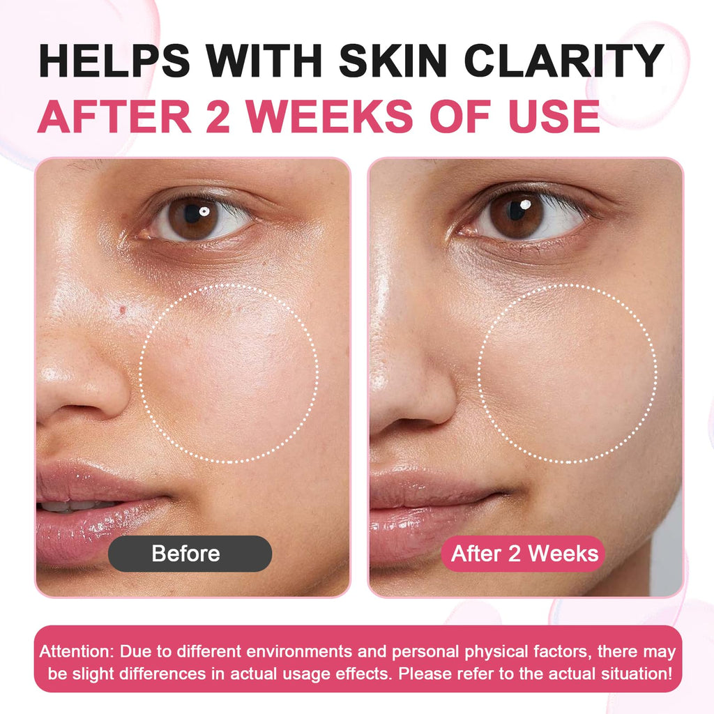 SUDAJI TXA + Niacinamide 15% Serum | Glow Facial Serum with Hyaluronic Acid