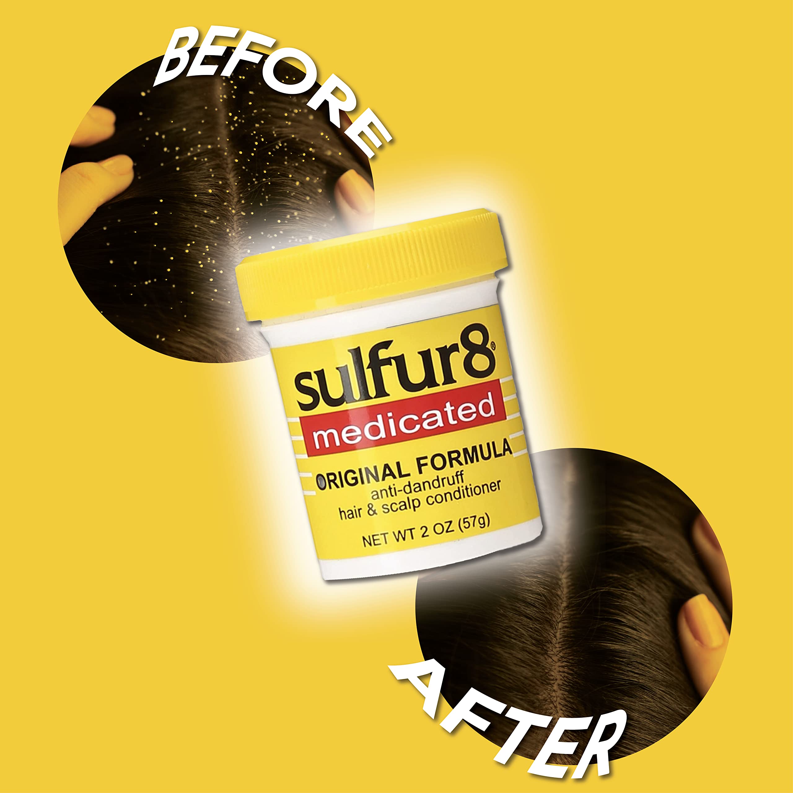 Sulfur 8 Medicated Anti-Dandruff Hair & Scalp Conditioner 2 oz (Pack of 2) – Soothes Itchy Scalp, Moisturizes Hair