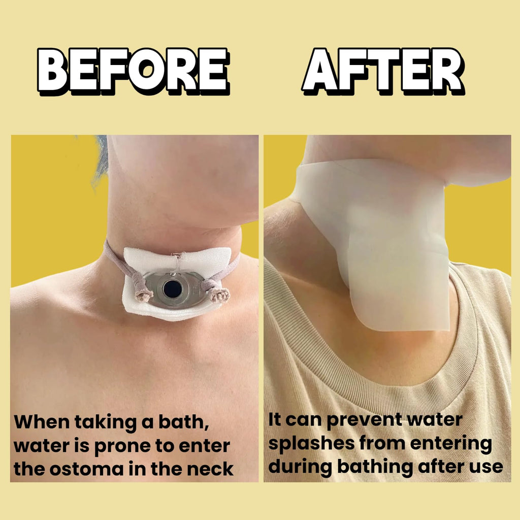 Sulieschen Stoma Guard Tracheostomy Shower Cover – Waterproof Silicone Neck Protection, Adjustable Fit