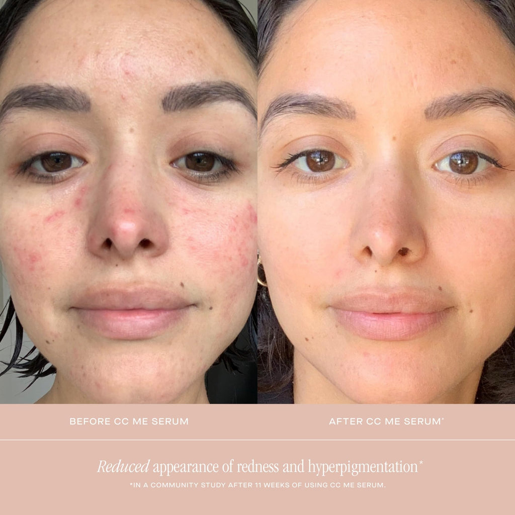Summer Fridays CC Me Serum with Vitamin C + Niacinamide | Brightening & Hydration (1 fl oz)