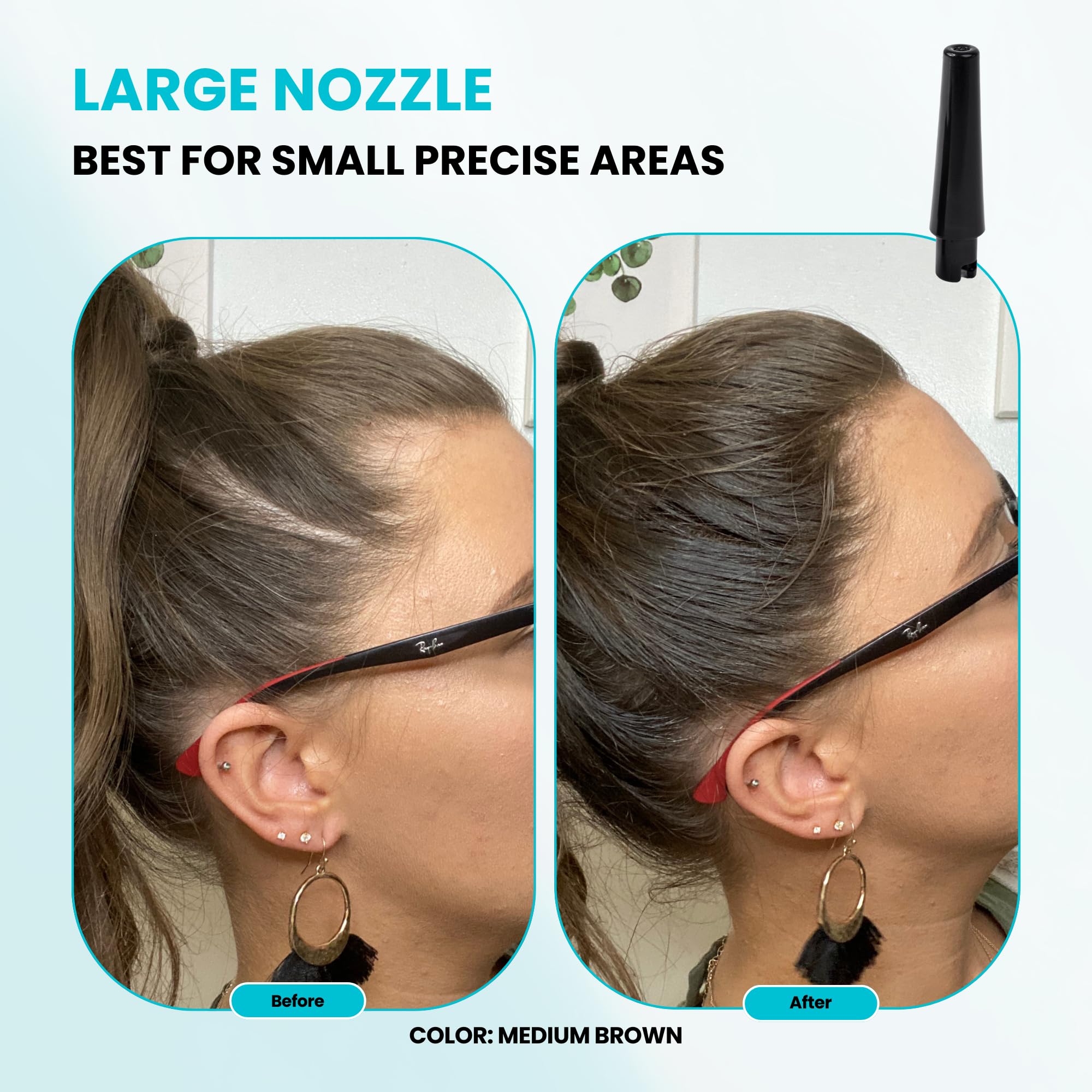 SURETHIK Hair Fiber Applicator Toolkit – Twist-On Pump, Hairline Tool & 3 Nozzles (Exclusive For SURETHIK Bottles)