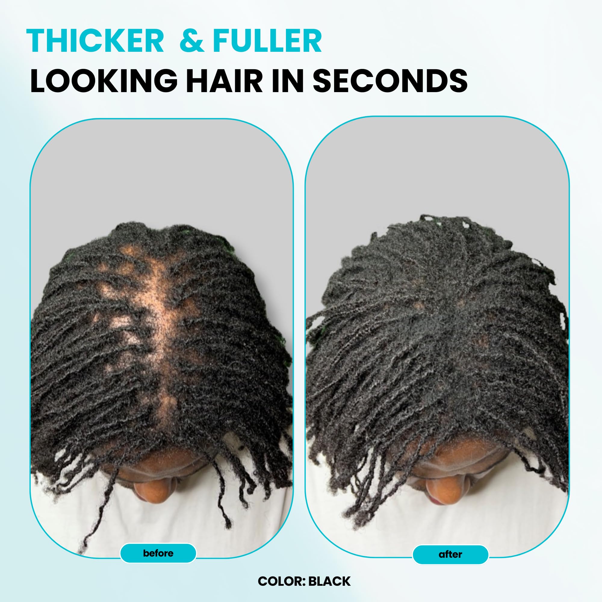 SURETHIK Hair Fibers 15g (Dark Brown) – Fuller, Natural-Looking Hair Coverage