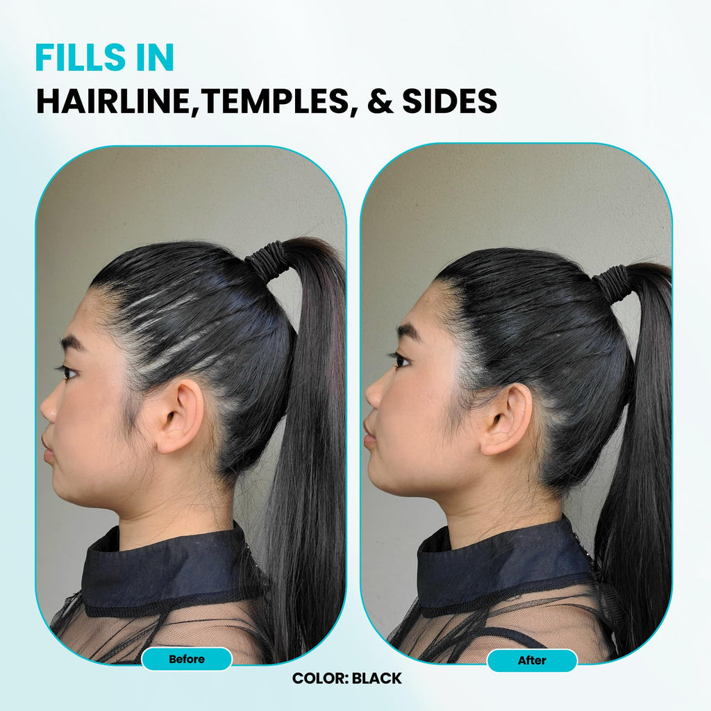 SURETHIK Medium Brown Hair Fibers for Thinning Hair - 30g | Instant Fuller Look for Men & Women