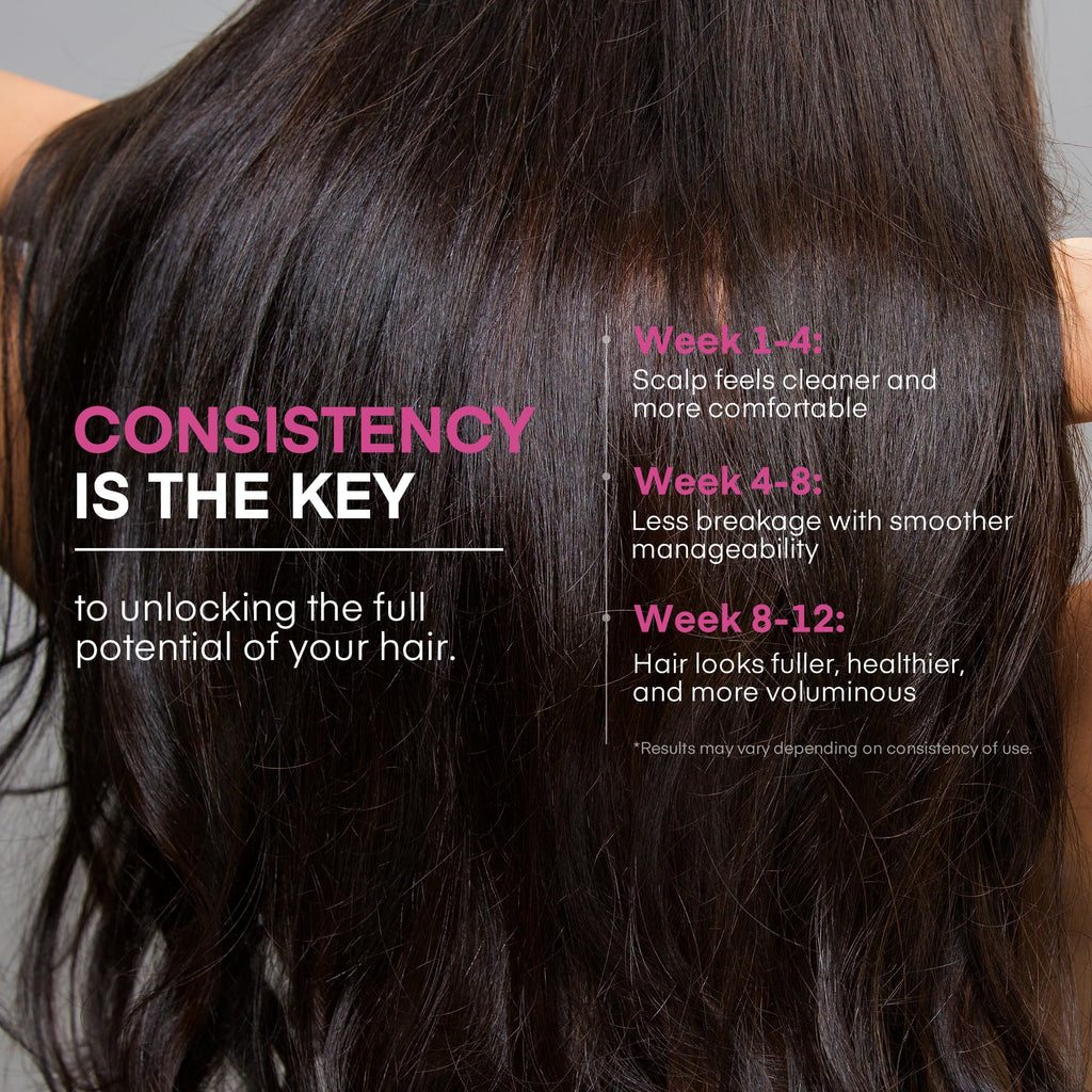 Svvimer Onion Rosemary & Biotin Shampoo — Volumizing, Sulfate-Free Hair Thickening 13.5 oz (Pack of 1)