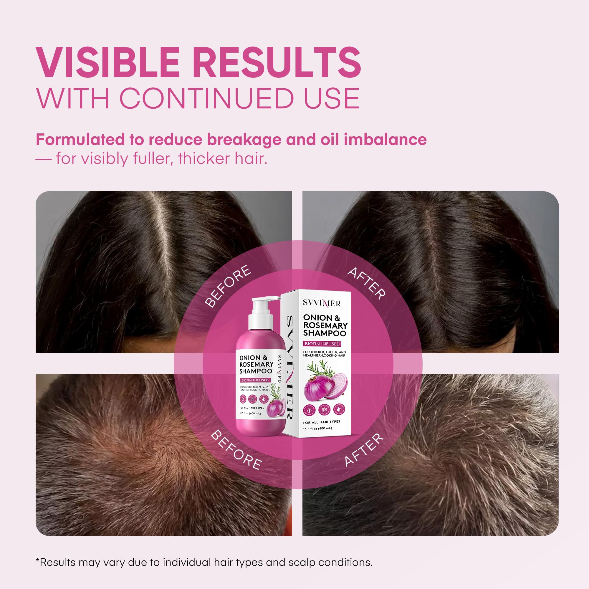 Svvimer Onion Rosemary & Biotin Shampoo — Volumizing, Sulfate-Free Hair Thickening 13.5 oz (Pack of 1)