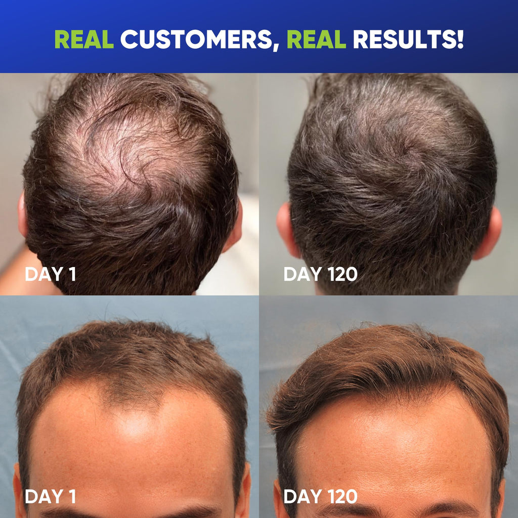 Svvimer Hair Growth Shampoo for Men – Biotin, Caffeine & Rosemary for Fuller-Looking Hair | 13.5 Fl Oz
