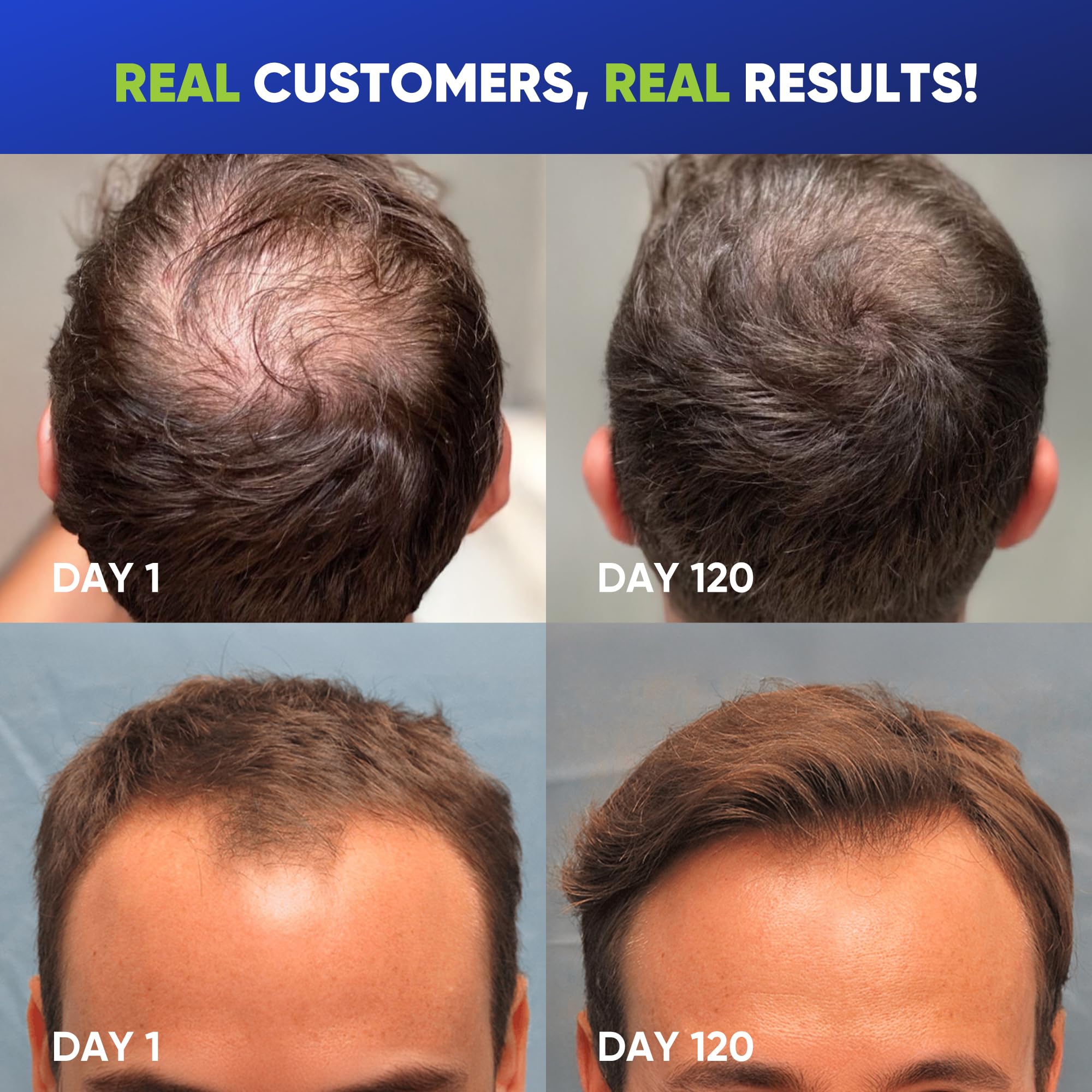 Svvimer Hair Growth Shampoo for Men – Biotin, Caffeine & Rosemary for Fuller-Looking Hair | 13.5 Fl Oz