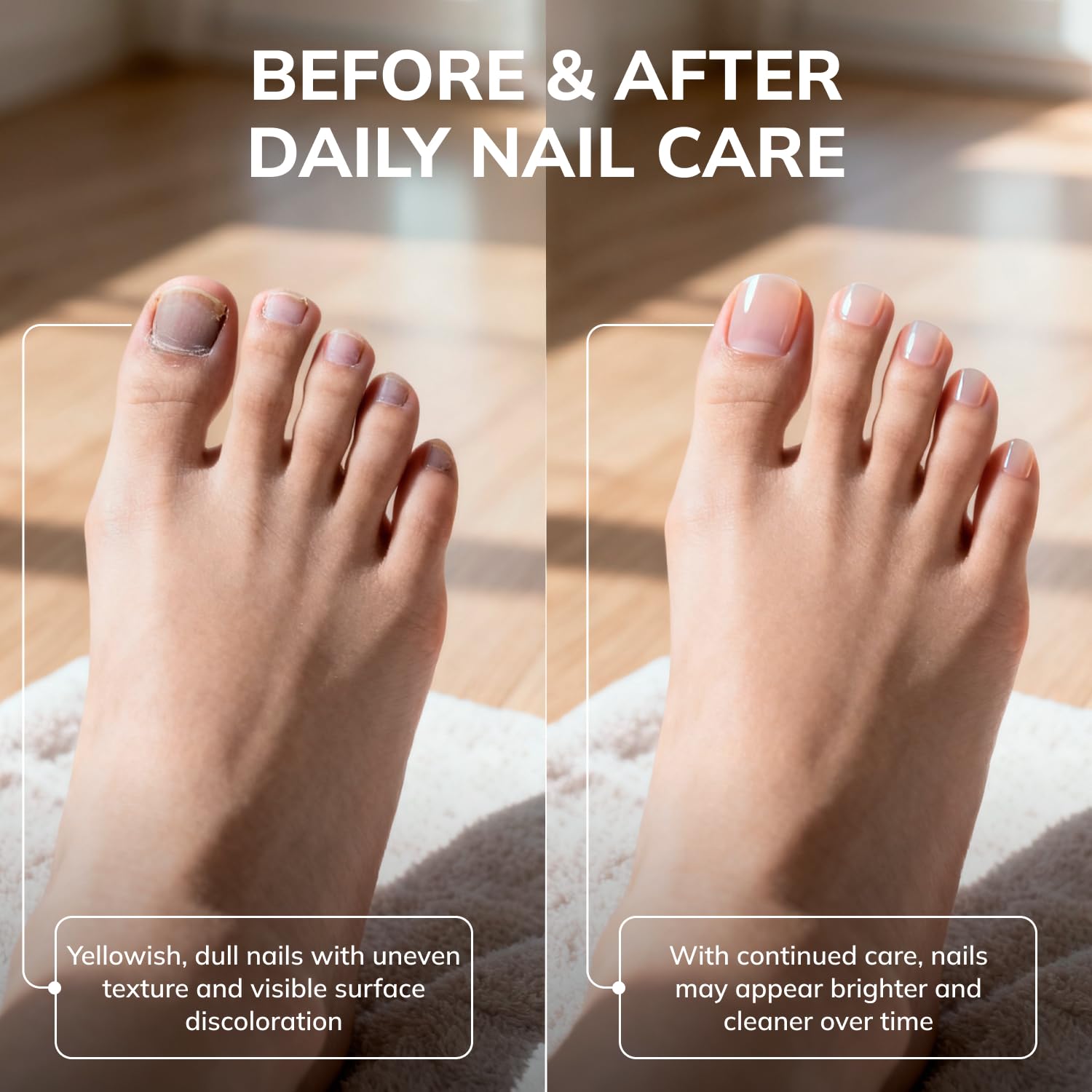 Swissklip Medi-Care KlearNail Toenail Stick – Natural Nail Renewal for Brittle Nails | Pack of 2 | 10ml | Made in USA