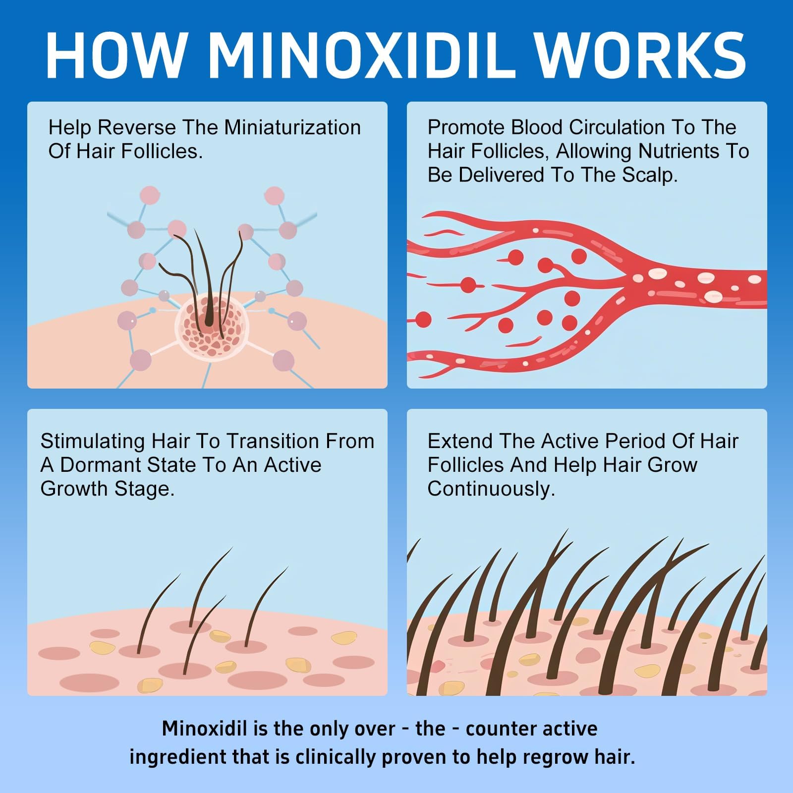 Tacruitf 5% Minoxidil with Biotin – Hair & Beard Growth Solution (6-Pack, 12 fl oz)