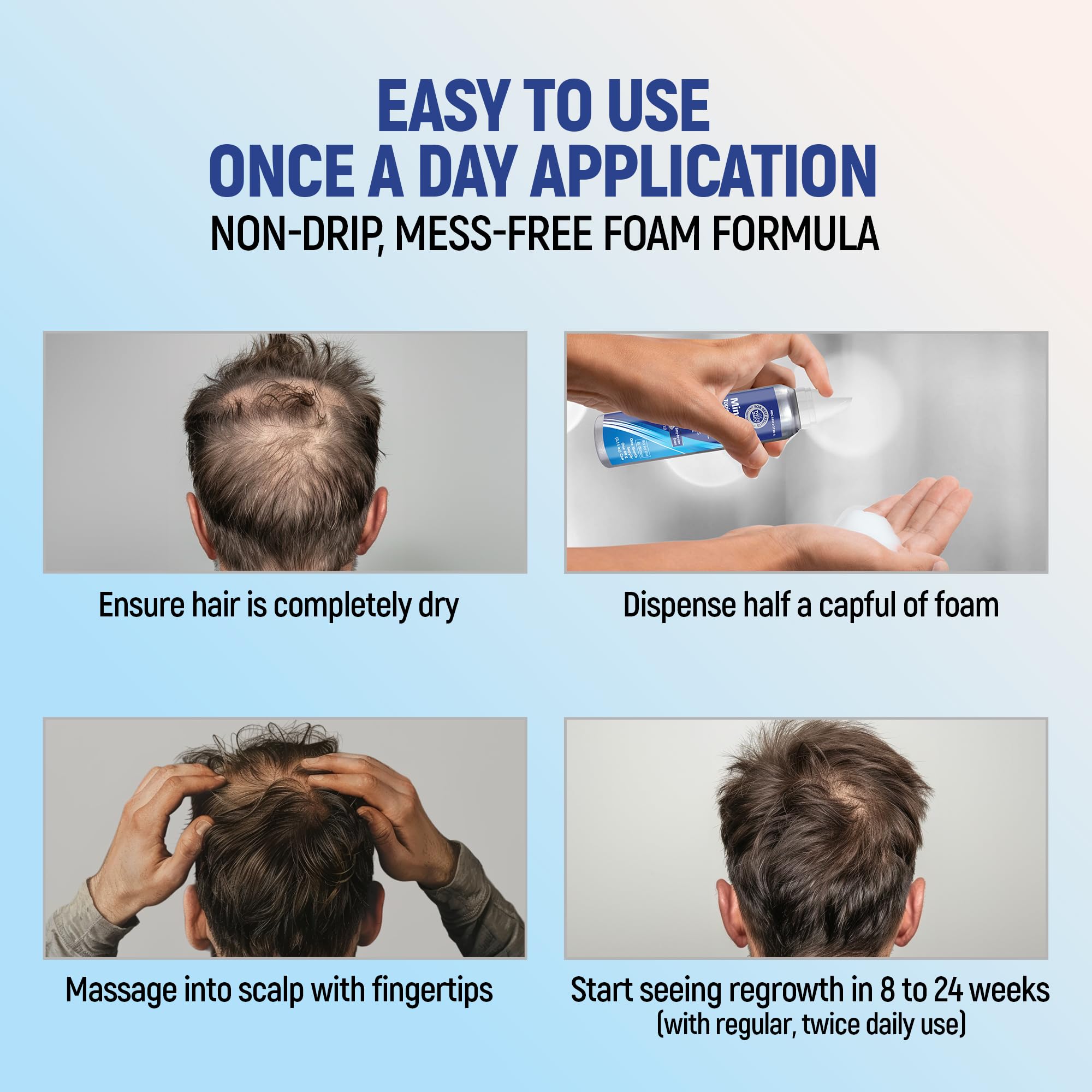 TARO Minoxidil Topical Aerosol Foam 5% for Men – Hair Regrowth Treatment, 2.11 oz (4 Pack)