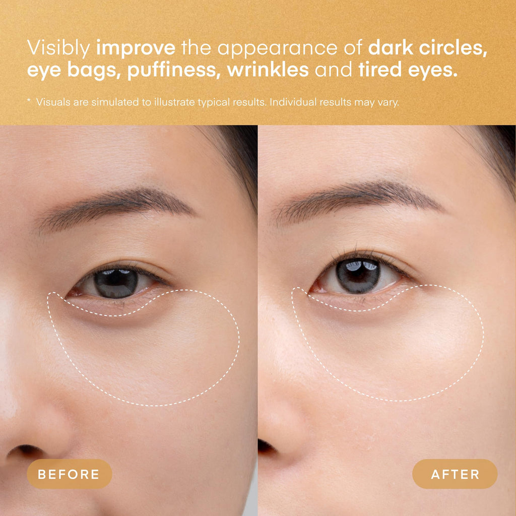 TEREZ & HONOR 24K Gold Retinol Eye Patches – 60-Patch Korean Hydrogel Set