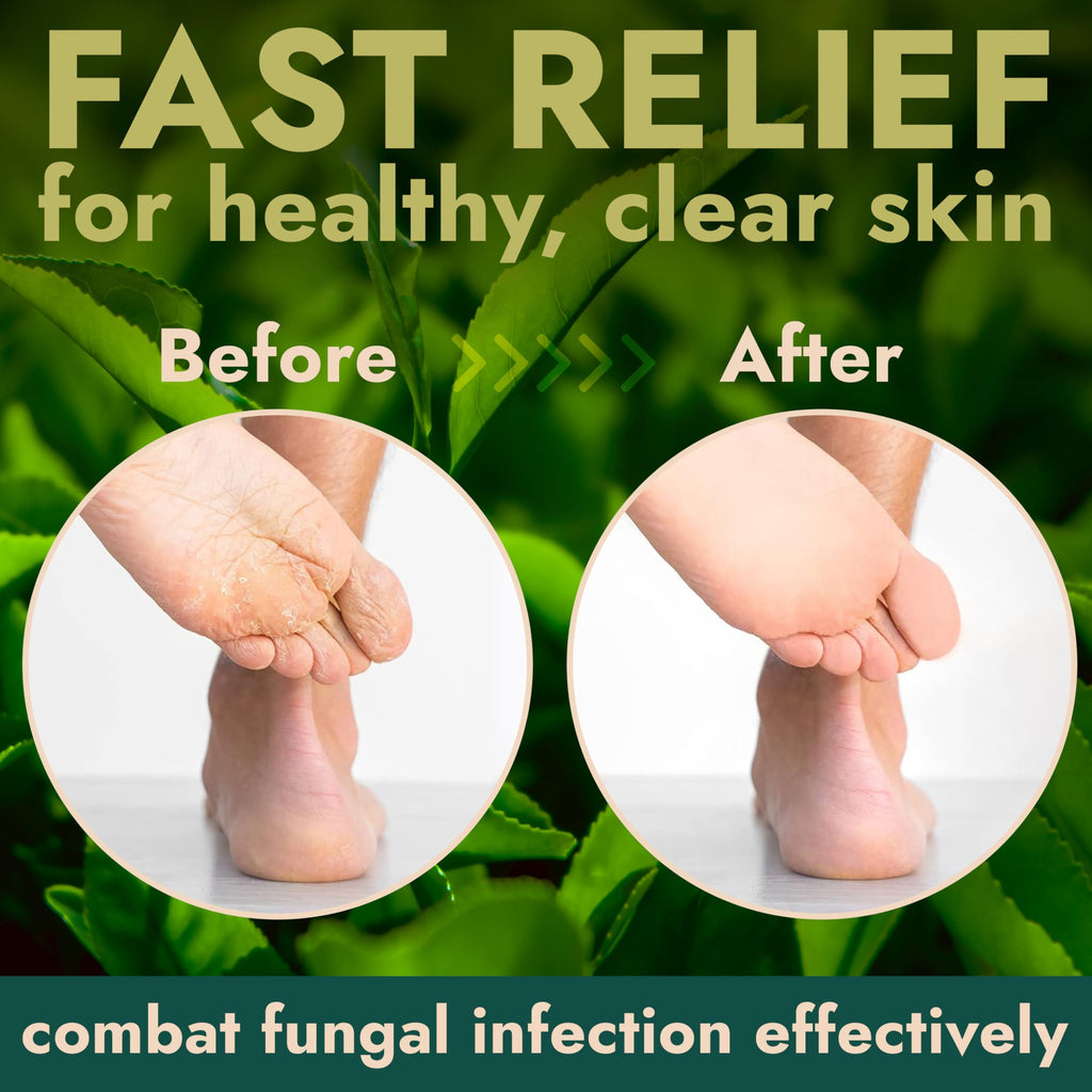Terramed Just Think Comfort Foot Scrub with Tea Tree Oil – Exfoliating Callus Remover for Feet