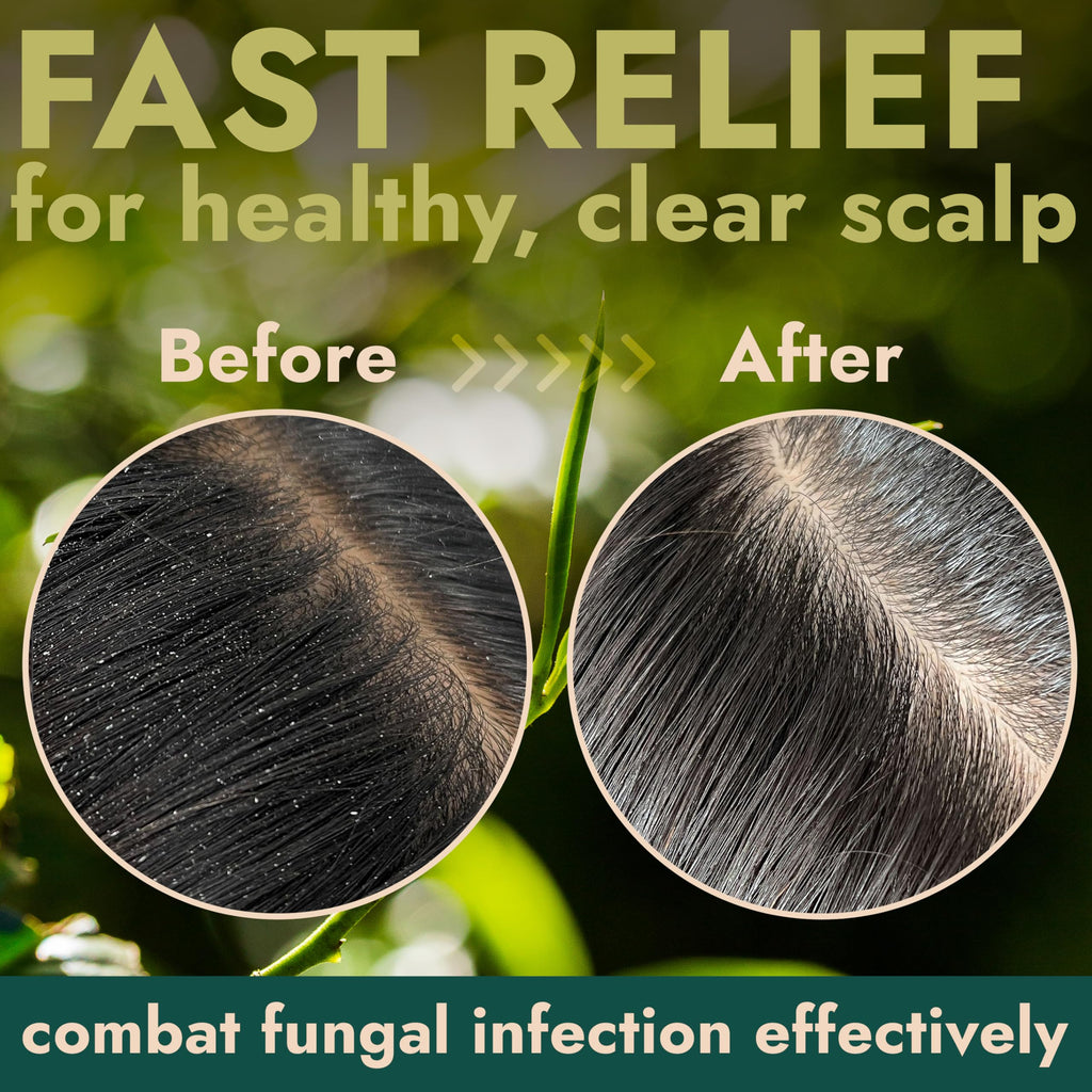 Terramed Tea Tree Scalp Scrub — Gentle Exfoliation for Itchy, Dry Scalp