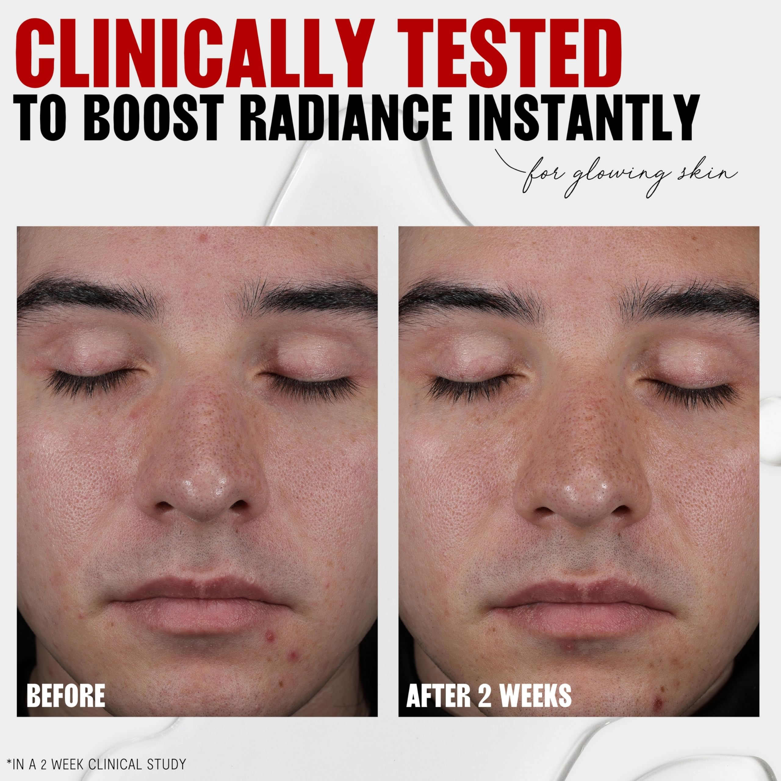 Thayers 2% AHA Toner with Glycolic & Lactic Acids – Alcohol-Free, Pore Refining Skin Care by THAYERS