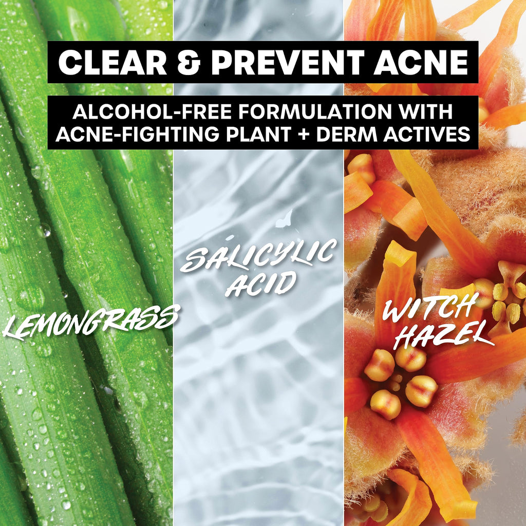 THAYERS Witch Hazel Blemish Cleanser, 4 oz  2% Salicylic Acid