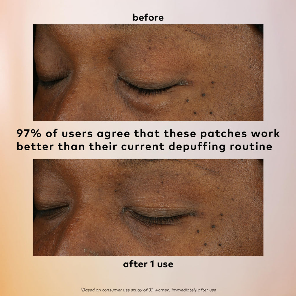 The Good Patch De-Puff Cooling Hydrogel Under Eye Patches — 12-Patch Set with Caffeine, Aloe & Gotu Kola