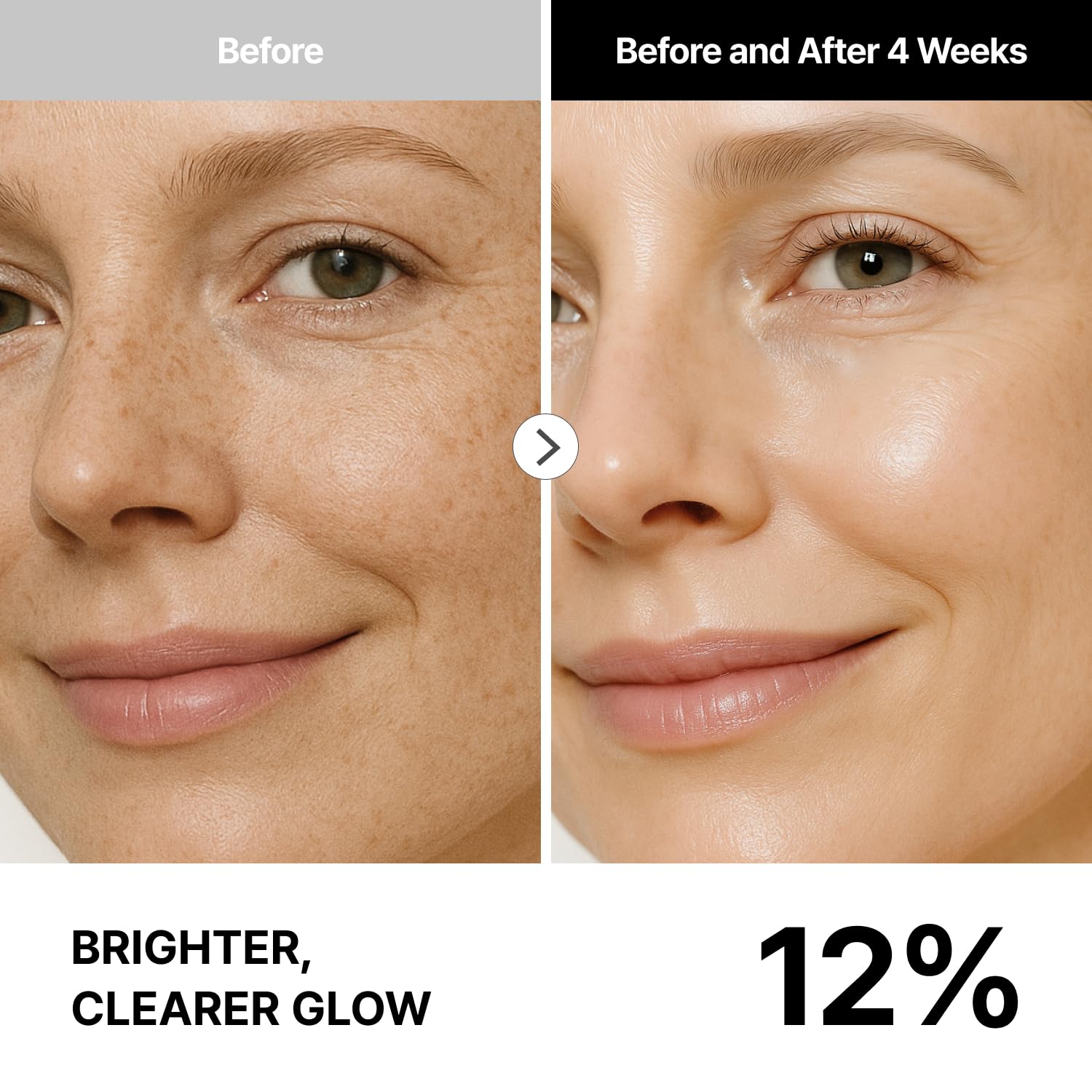THOME G-Peel 4-Week Kit: Hydrating & Firming Korean Facial – Skin Cycling